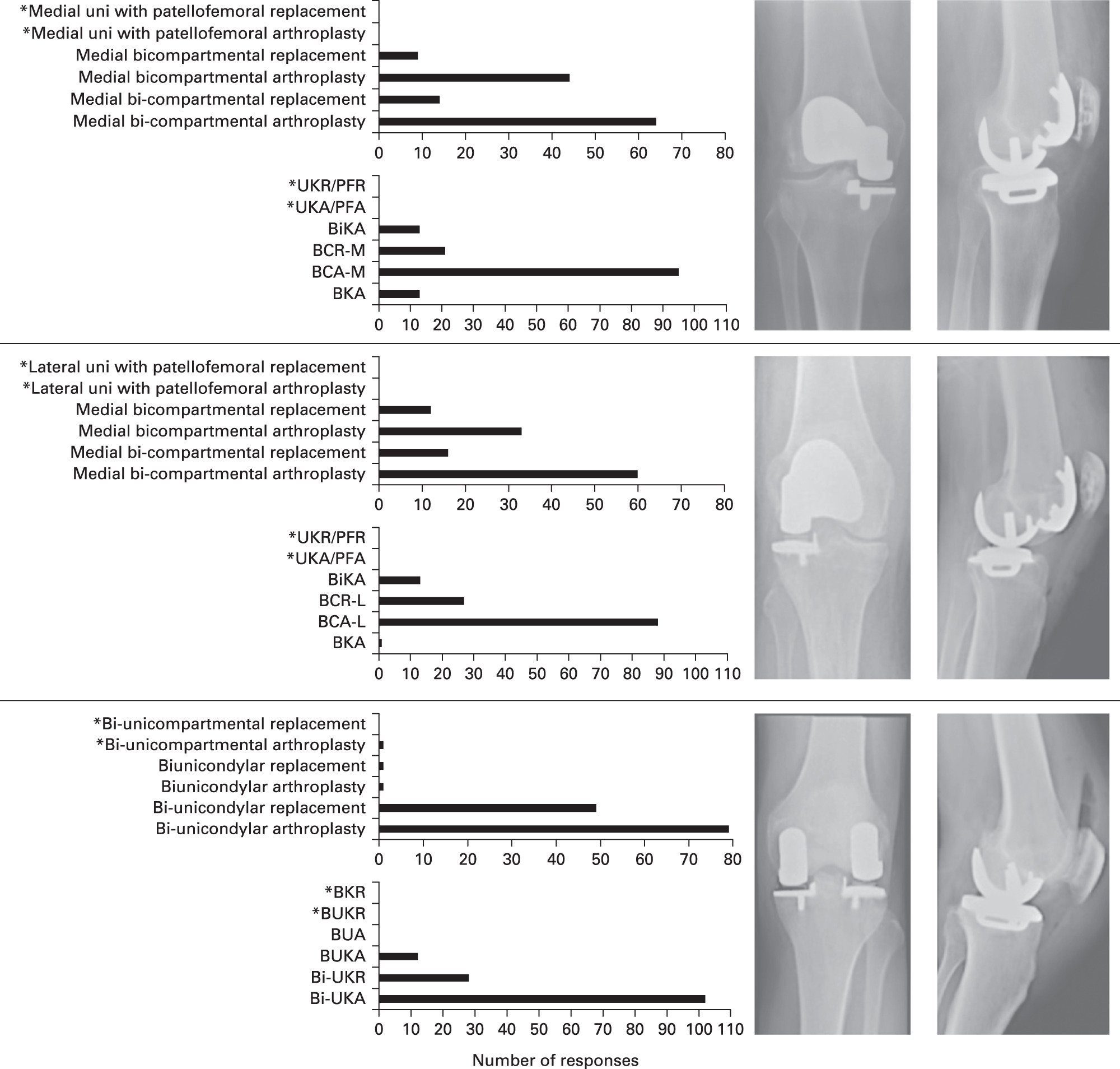 Fig. 1 
          Collective results of the two surveys completed by orthopaedic speciality registrars (survey 1) and orthopaedic surgeons, speciality registrars, and arthroplasty biomechanical engineers (survey 2) regarding terminology and abbreviations for combined partial knee arthroplasty procedures. *Excluded from second survey.
        
