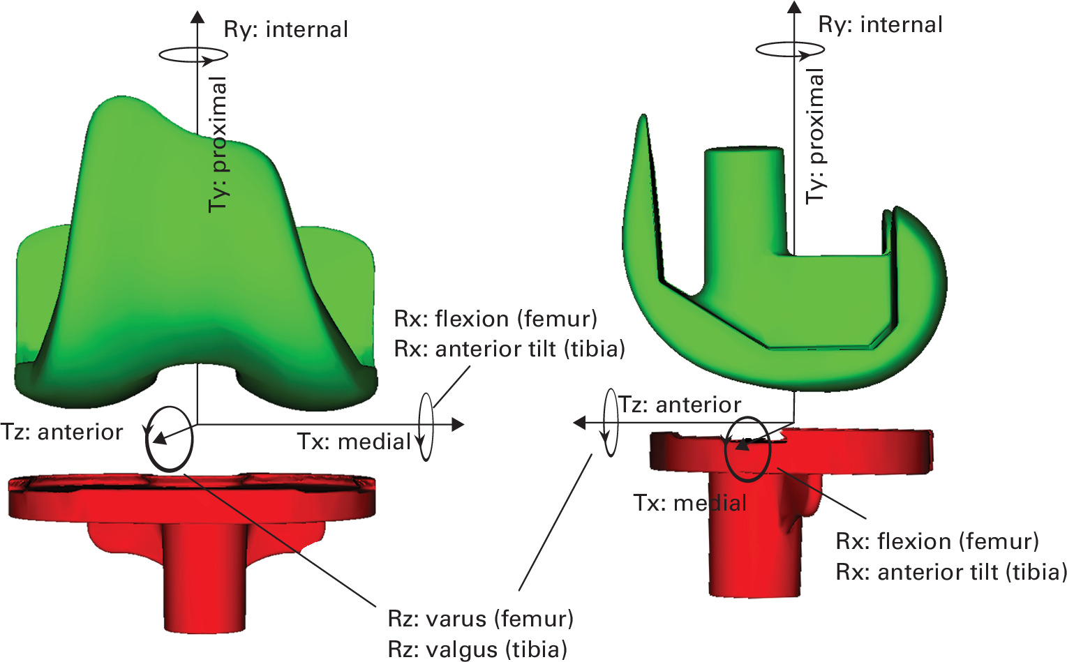 Fig. 2 
          Orientation of the longitudinal, transverse, and sagittal axes and the directions of positive translation (T) and rotation (R) for the femur and tibia.
        