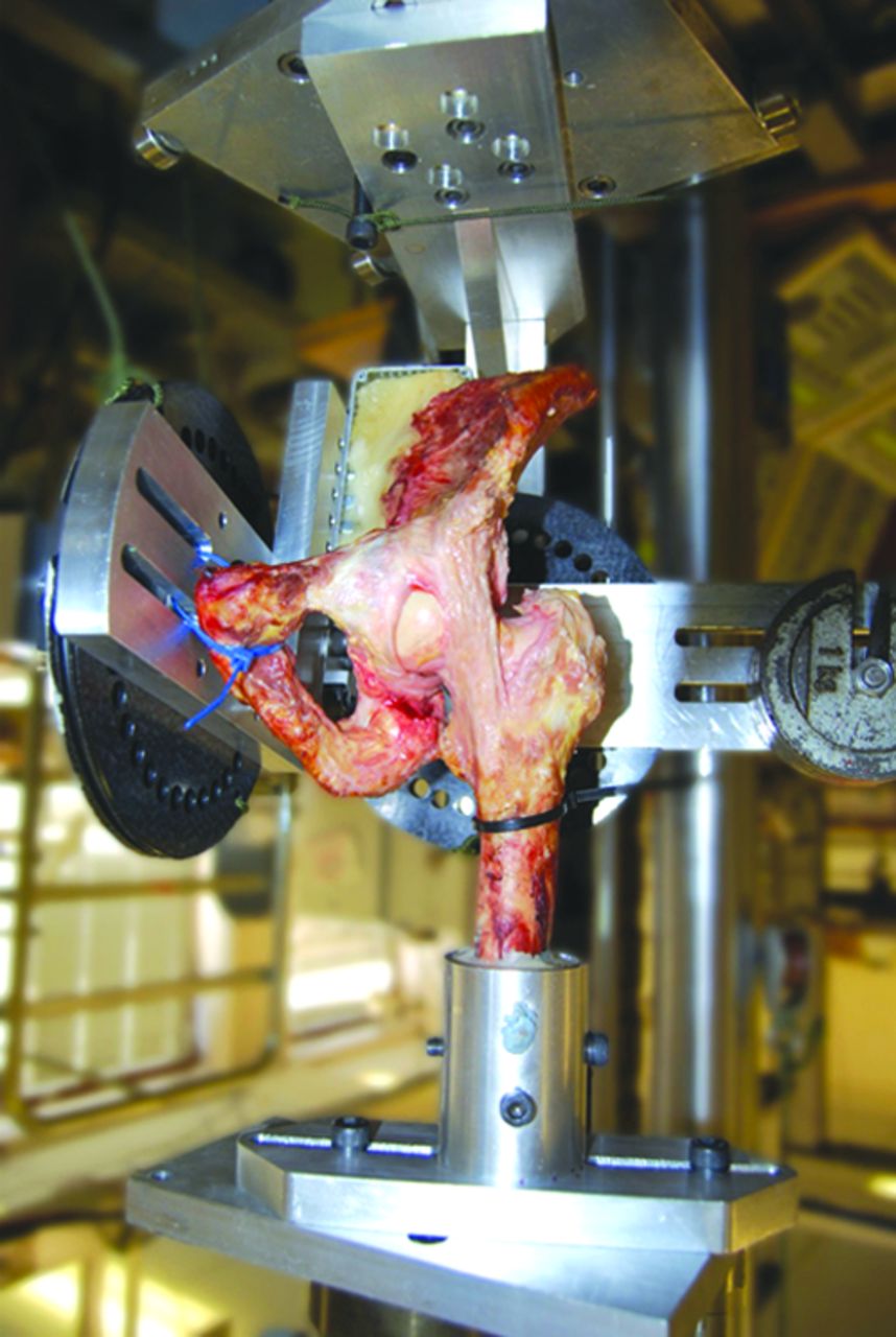 Fig. 1 
          Photograph showing the anterior
view of a left hemi-pelvis mounted in the custom-built testing rig.
The hip is in neutral ad/abduction, extension and external rotation
and all capsular ligaments have been resected except for the medial
iliofemoral ligament, which can be seen to be taut.
        