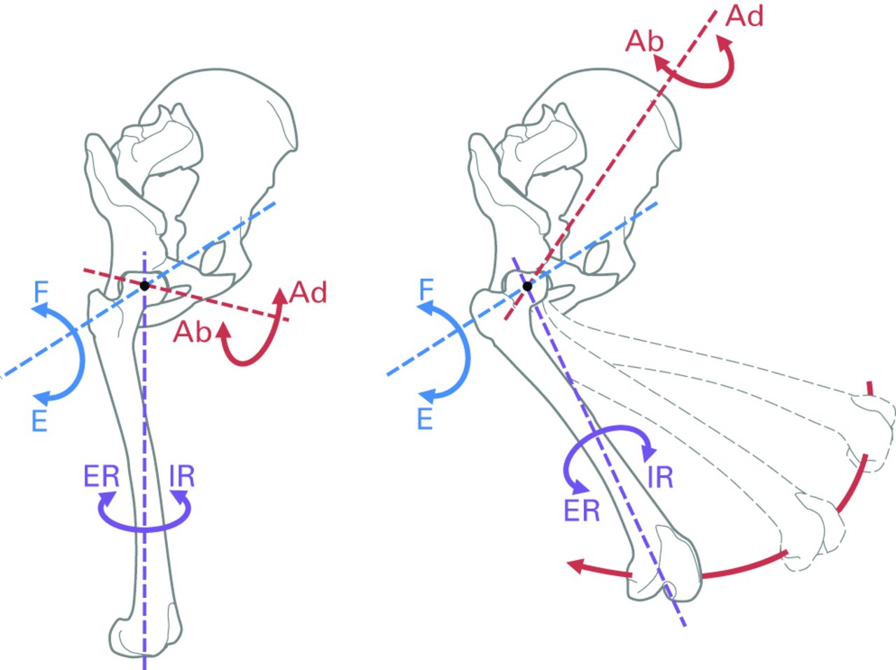 Fig. 2 
          Diagram showing the co-ordinate system
used throughout testing. The axis for flexion/extension (F/E, blue)
is fixed to the pelvis. The axis for internal/external rotation
(IR/ER, purple) is fixed to the femoral mechanical axis (connecting
the hip and knee joint centres). The axis for ab/adduction (Ab/Ad,
red) is floating and varies with hip flexion; ab/adduction moves
the knee away-from/towards the sagittal plane (without changing
the angle of hip flexion or rotation).
        