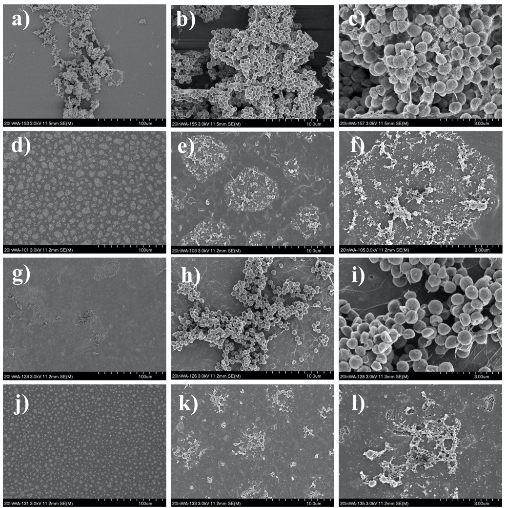 Fig. 3 
            Representative scanning electron microscopy (SEM) images of biofilm on titanium discs in different magnifications (a, d, g, j: 500×; b, e, h, k: 5,000×; c, f, i, l: 15,000×). a) to c) Control group. d) to f) 500 impulses of focused high-energy extracorporeal shockwave therapy (fhESWT) without antibiotics. g) to i) Rifampin 200 μg/ml without fhESWT. j) to l) 500 impulses of fhESWT + rifampin 200 μg/ml.
          