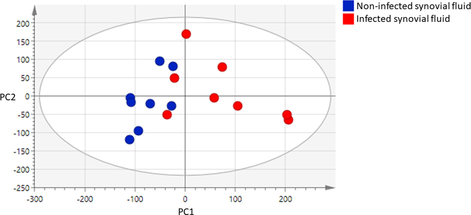 Fig. 1 
            Principal component (PC) analysis scores plot of PC1 versus PC2, with each data point representing the nuclear magnetic resonance spectrum of an individual human synovial fluid sample and demonstrating separation between the infected and noninfected groups. Data were scaled to unit variance. The percentage variation explained is 38% for PC1 and 21% for PC2.
          