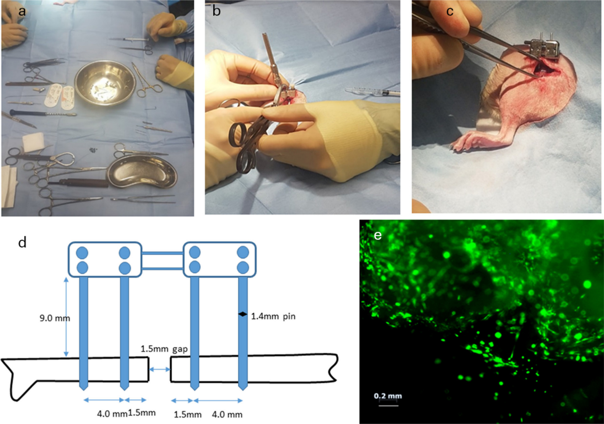 Fig. 1 
            a) Photographs of surgical instruments required, b) intraoperative image of pin placement, and c) intraoperative image of fixator prior to wound closure; d) fluorescent microscope image of cells stained with live-dead in fibrin glue; e) a pictorial representation of the ex-fixator system.
          