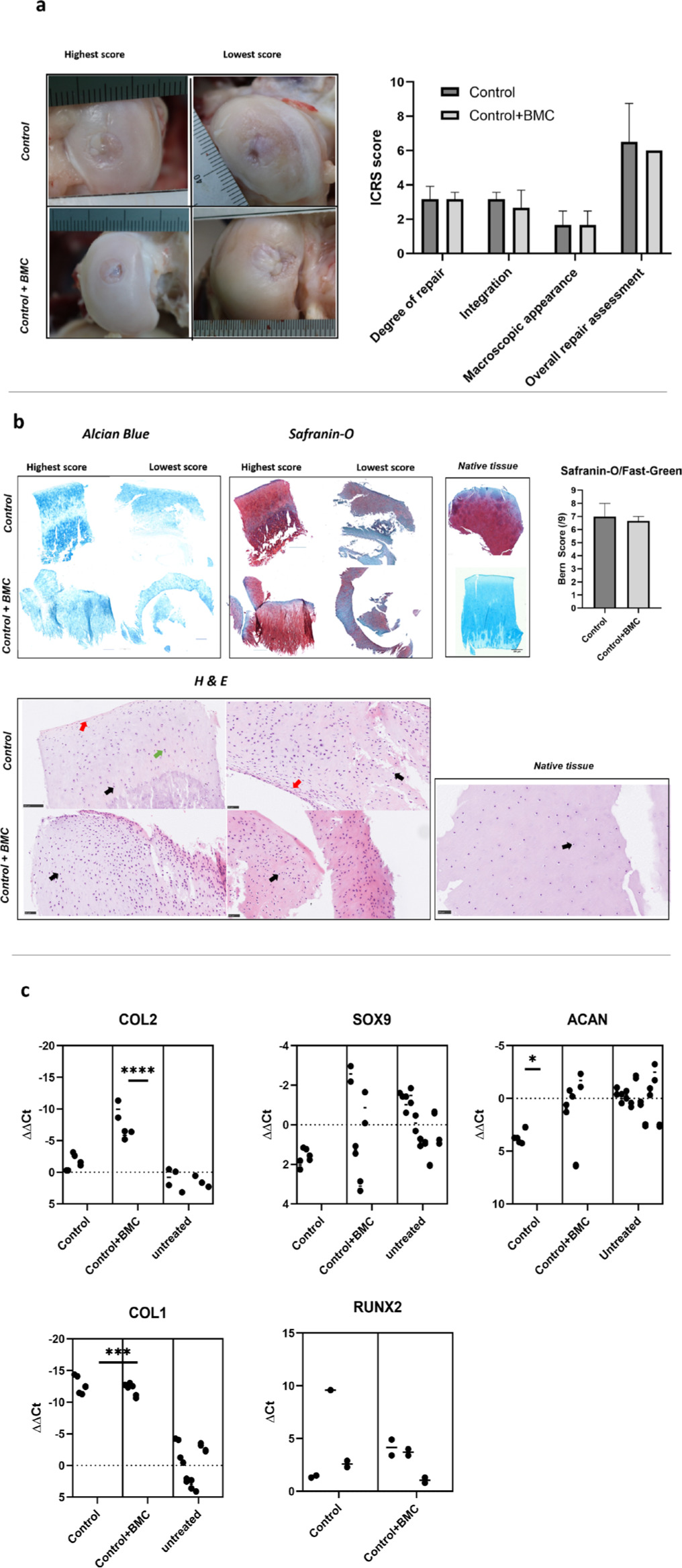 Fig. 4 
            Evaluation of regenerated cartilage at six months: a) Gross view and macroscopic evaluations showing best and worst cases in each group. ICRS, International Cartilage Regeneration & Joint Preservation Society (ICRS) scoring did not show any macroscopic differences between control and bone marrow concentrate (BMC) groups. b) Histology (alcian blue, Safranin-O, and haematoxylin and eosin (H&E) staining), with best and worst repair tissues shown in each case. Bern score evaluation of Safranin-O staining showed no statistically significant difference between the groups. H&E staining shows chondrocytes in their lacunae (black arrow) in both groups. Flattened chondrocytes (red arrow) and dividing chondrocytes (green arrow) are shown. No inflammatory response in form of mononuclear cell infiltration was observed, however, compared to healthy hyaline cartilage more cells were present in both groups. c) Chondrogenic and osteogenic gene expression analysis. Upregulation of type II collagen (COL2) in the BMC group, and downregulation of aggrecan (ACAN) in the control group. COL1 was upregulated and RUNX2 was expressed in both groups. All comparisons are with untreated normal cartilage indicated as “untreated” in the graph. Ct corresponds to cycle threshold. Scale bar = 200 μm (alcian blue and Safranin-O), 50 μm (H&E). Error bars: standard error of means.
          