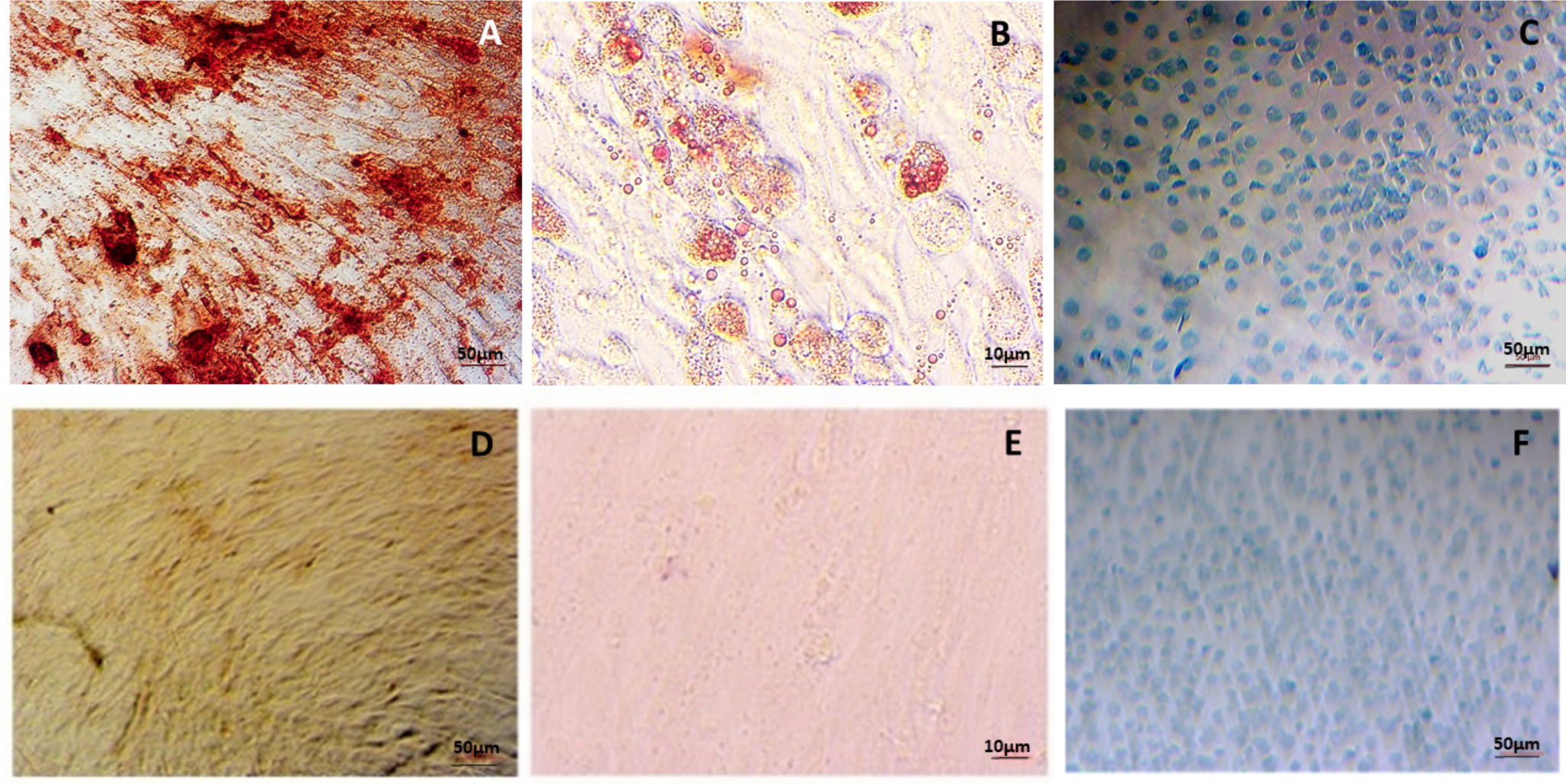 Fig. 1 
          a) Alizarin Red, b) Oil Red O, and c) Alcian Blue stain for adipose-derived mesenchymal stem cells and their negative controls differentiated to d) bone, e) fat, and f) cartilage, respectively, after 21 days (n = 4).
        