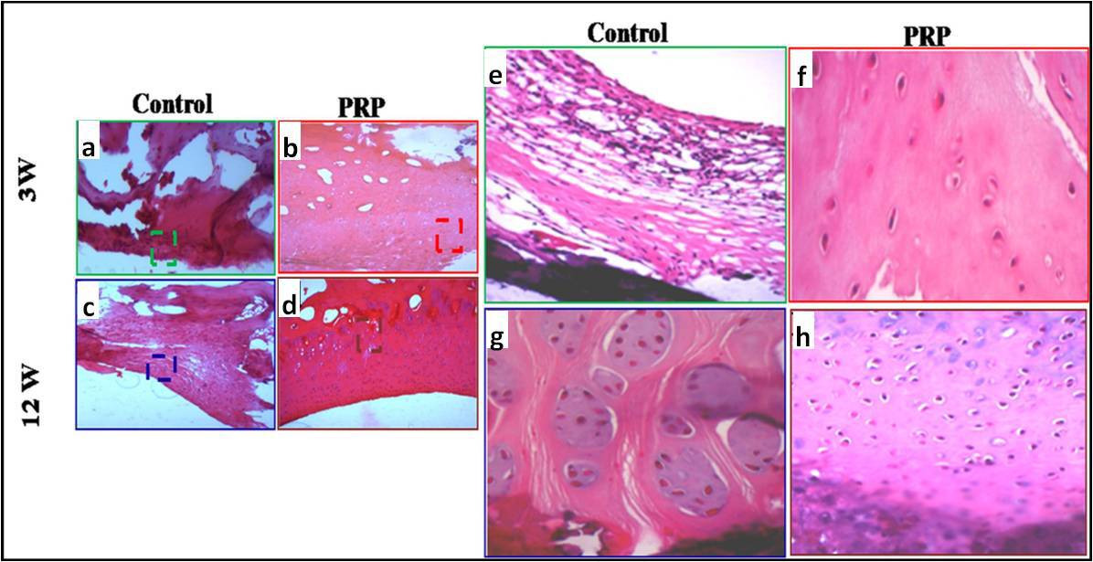 Fig. 4 
            a) to d) Haematoxylin and eosin staining: a) to d) original magnification: 100×; e) to h) original magnification: 200×. e) and f) Microphotographs showing the repair tissue at week 3. a) and e) Control: fibrous tissue. b) and f) Presence of slightly differentiated cartilaginous tissue. c) and g) Control: fibrocartilaginous tissue. d) and h) good differentiated cartilaginous tissue at week 12. PRP, platelet-rich plasma.
          