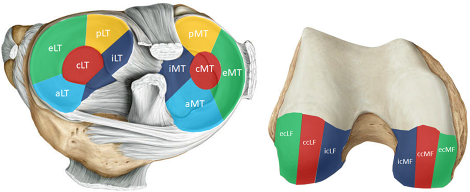 Fig. 2 
            The analyzed subregions at the tibia (left) and the femur (right). aLT, anterior lateral tibia; aMT, anterior medial tibia; ccLF, central lateral femur; ccMF, central medial femur; cLT, central lateral tibia; cMT, central medial tibia; ecLF, external central lateral femur; ecMF, external central medial femur; eLT, external lateral tibia; eMT, external medial tibia; icLF, internal central lateral femur; icMF, internal central medial femur; iLT, internal lateral tibia; iMT, internal medial tibia; pLT, posterior lateral tibia; pMT, posterior medial tibia.
          