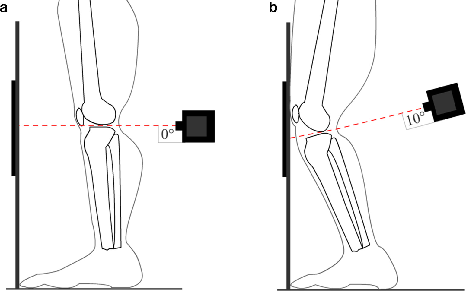 Fig. 3 
            Posteroanterior radiography with a) upright standing position with the great toes touching the anterior wall of the frame and both feet in 10° external rotation, and b) both knees and thighs pressed against the anterior wall of the frame in order to fix flexion of the knees, resulting in vertical alignment of the patella, toes, and chest. The x-ray beam is angled 10° caudal and centred at the level of the joint line until the anterior and posterior margins of the tibial plateau superimposed.
          