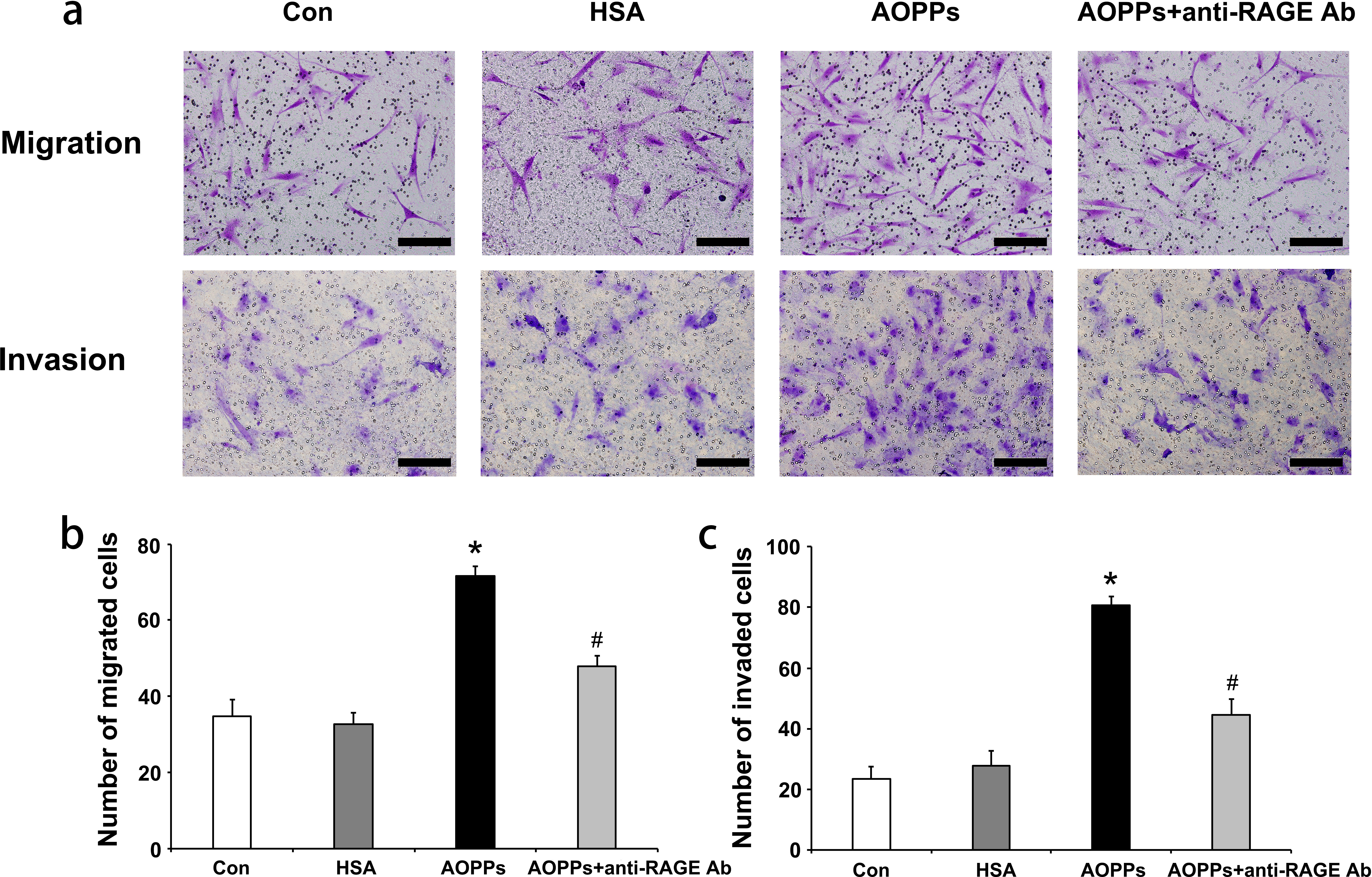 Fig. 1 
            a) Advanced oxidation protein products (AOPPs) promote the migration and invasion of rheumatoid arthritis fibroblast-like synoviocytes (RA-FLSs) in vitro. After RA-FLSs were incubated with medium alone (control), native human serum albumin (HSA), or AOPP-HSA (100 μg/ml) for 48 hours, cell migration and cell invasion were measured. In the blocking test, RA-FLSs were pretreated with a neutralizing anti-receptor for advanced glycation end products (RAGE) antibody (10 µg/ml) for one hour, followed by treatment with AOPP-HSA (100 µg/ml) for 48 hours. b) and c) The migrated and invaded cells were imaged (200× magnification) and counted in five random fields for each treatment (n = 3). Data are presented as the mean and standard deviation of triplicates. Scale bar, 50 µm. *p < 0.05 versus medium alone (control). #p < 0.05 versus the AOPP group. Con, control.
          