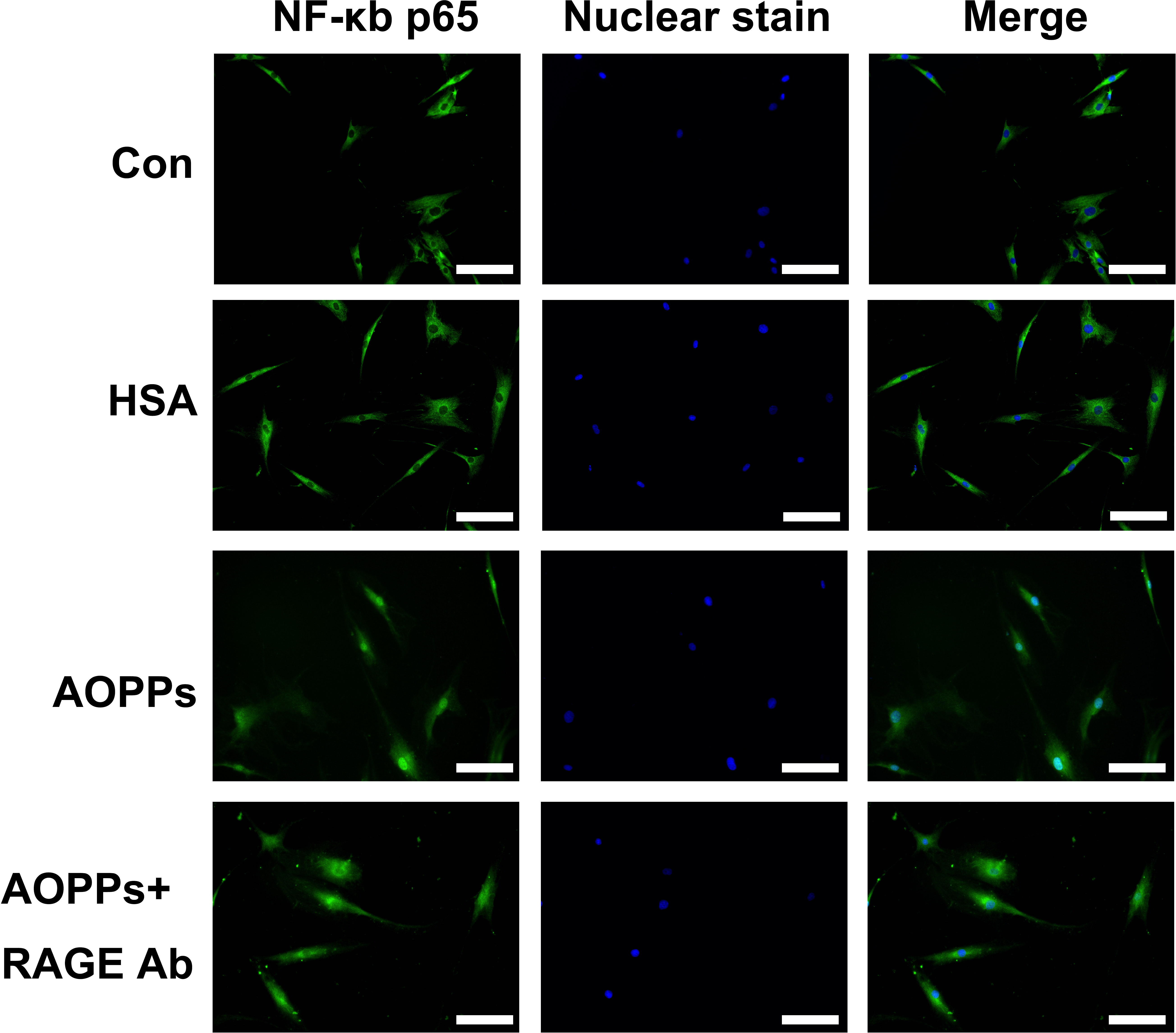 Fig. 3 
            NF-κB p65 translocation was detected by immunofluorescence and 4′,6-diamidino-2-phenylindole (DAPI) staining. Fluorescence micrographs with staining for nuclear factor-κB (NF-κB) p65 (green) and nuclei (blue) after rheumatoid arthritis fibroblast-like synoviocytes (RA-FLSs) were treated with advanced oxidation protein product-human serum albumin (AOPP-HSA) (100 μg/ml), medium alone (control), or native HSA for three hours. Magnification 400×. White scale bars represent 50 µm. Representative images of three independent experiments were shown. Con, control; RAGE, receptor for advanced glycation end products.
          
