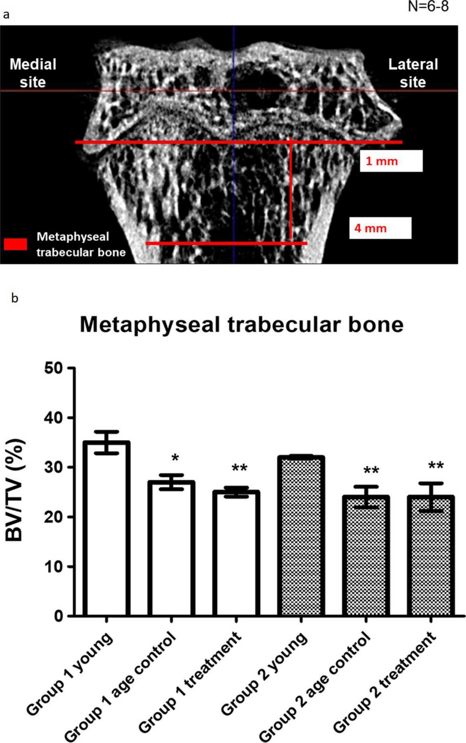 Fig. 5 
            a) Definition of bone microarchitecture measurement metaphyseal trabecular bone microarchitecture in microcalculated tomography (μCT). At the age of six months (Group 1), guinea pigs were assigned into a control (Group 1 control; n = 7) or osteoarthritis (OA) with parathyroid hormone (PTH) (1-34) treatment (Group 1 treatment) group (n = 8). Another eight three-month-old guinea pigs were purchased and served as the young control group (Group 1 young; n = 8). Guinea pigs at seven months old (Group 2) were randomized into either the control (Group 2 control; n = 6) or OA with PTH (1-34) treatment (Group 2 treatment) group (n = 6). Another eight four-month-old guinea pigs were purchased and served as the young control group (Group 2 young; n = 8). All guinea pigs received treatment once per week for three months. b) The quantifications of metaphyseal trabecular volume are shown. Bone volume (BV)/total volume (TV) ratio declined with ageing. There was no significant difference after PTH (1-34) treatment in the same group. Each bar represents the mean and standard error of the mean of samples in each group. *p < 0.05 versus Group 1 young group. **p < 0.01 versus Group 1 young group.
          