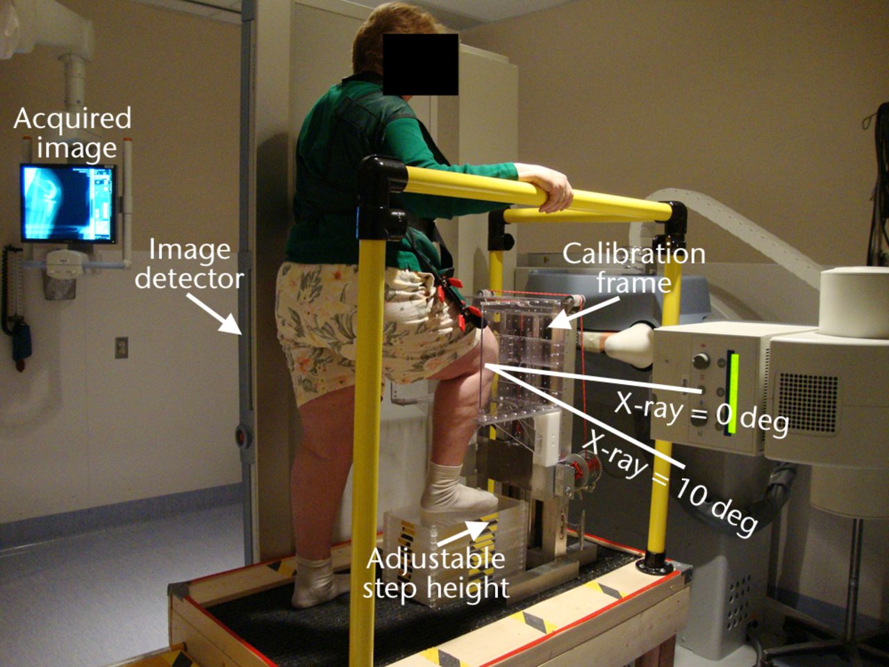 Fig. 1 
            Photograph showing the setup for
sagittal imaging, with the subject standing on a platform with the
right leg flexed and weightbearing and the right knee surrounded
by a calibration frame. The flat panel image detector slides inside
the vertical bed automatically with the X-ray source as it moves
to acquire the biplane images in succession.
          