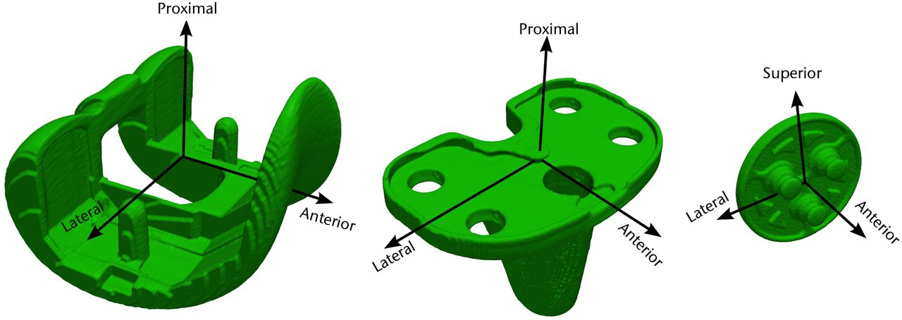 Fig. 3 
            Diagrams showing the coordinate systems
for the femoral (left), tibial (centre), and patellar (right) prostheses,
for use in the post-operative knees.
          