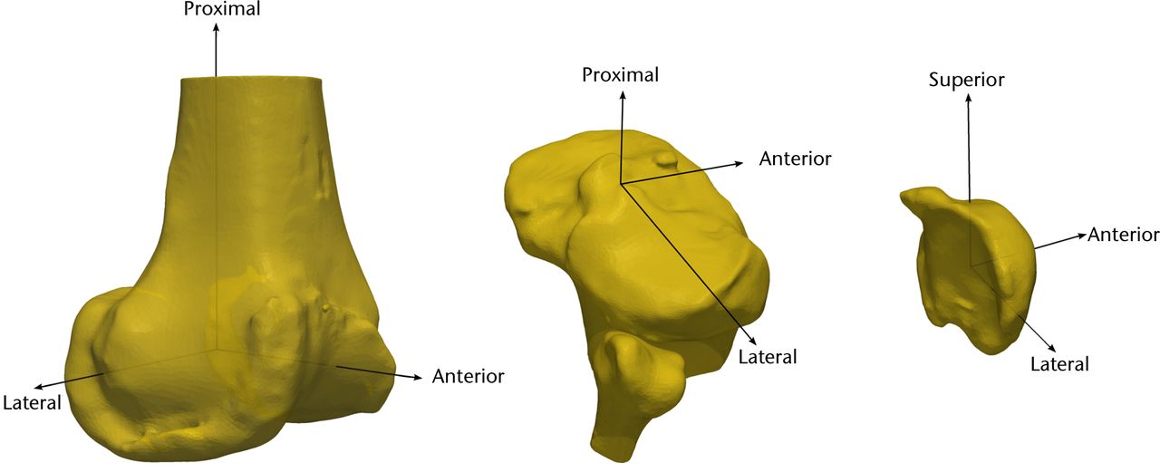 Fig. 4 
            Diagrams showing the coordinate system
for the femur (left), tibia (centre), and patella (right), for use
in the pre-operative knees.
          