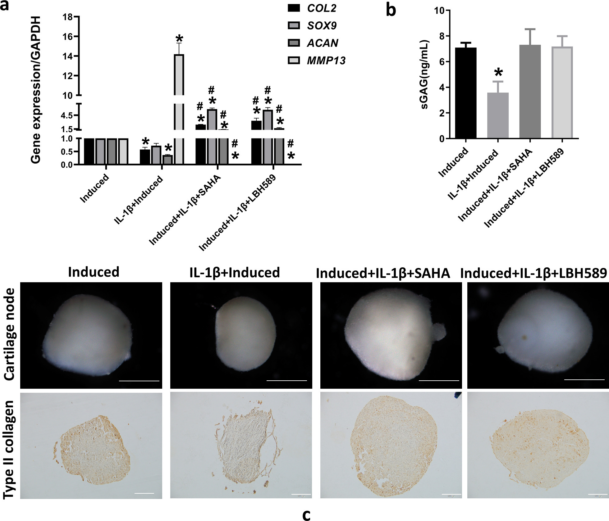 Fig. 2 
            Histone deacetylase (HDAC) inhibitor reverses interleukin (IL)-1β-induced inhibition of synovium-derived mesenchymal stem cell (SMSC) chondrogenesis. a) Messenger RNA expression of type II collagen (COL2), SRY-box transcription factor 9 (SOX9), aggrecan (ACAN), and matrix metalloproteinase 13 (MMP13) using reverse transcription-quantitative polymerase chain reaction (RT-qPCR) after SMSCs were co-treated with 10 ng/ml IL-1β and 10 μM suberoylanilide hydroxamic acid (SAHA) or 3 μM LBH589 during chondrogenic induction. b) Soluble sulphated glycosaminoglycan (sGAG) in culture supernatant, as determined by enzyme-linked immunosorbent assay. c) The size of cartilage pellets by stereoscopic microscope observation. Scale bar = 0.5 mm. Type II collagen immunochemical staining of cartilage pellet sections. Scale bar = 100 μm. *p < 0.05 compared to the chondrogenic induced group. #p < 0.05 compared to the chondrogenic induced group with IL-1β treatment. One-way analysis of variance was used to determine the p-values. Least-Significant Difference (LSD) test was used to analyze data with homogeneous variances, and Games-Howell test was used for data with non-homogeneous variances. GAPDH, glyceraldehyde-3-phosphate dehydrogenase.
          