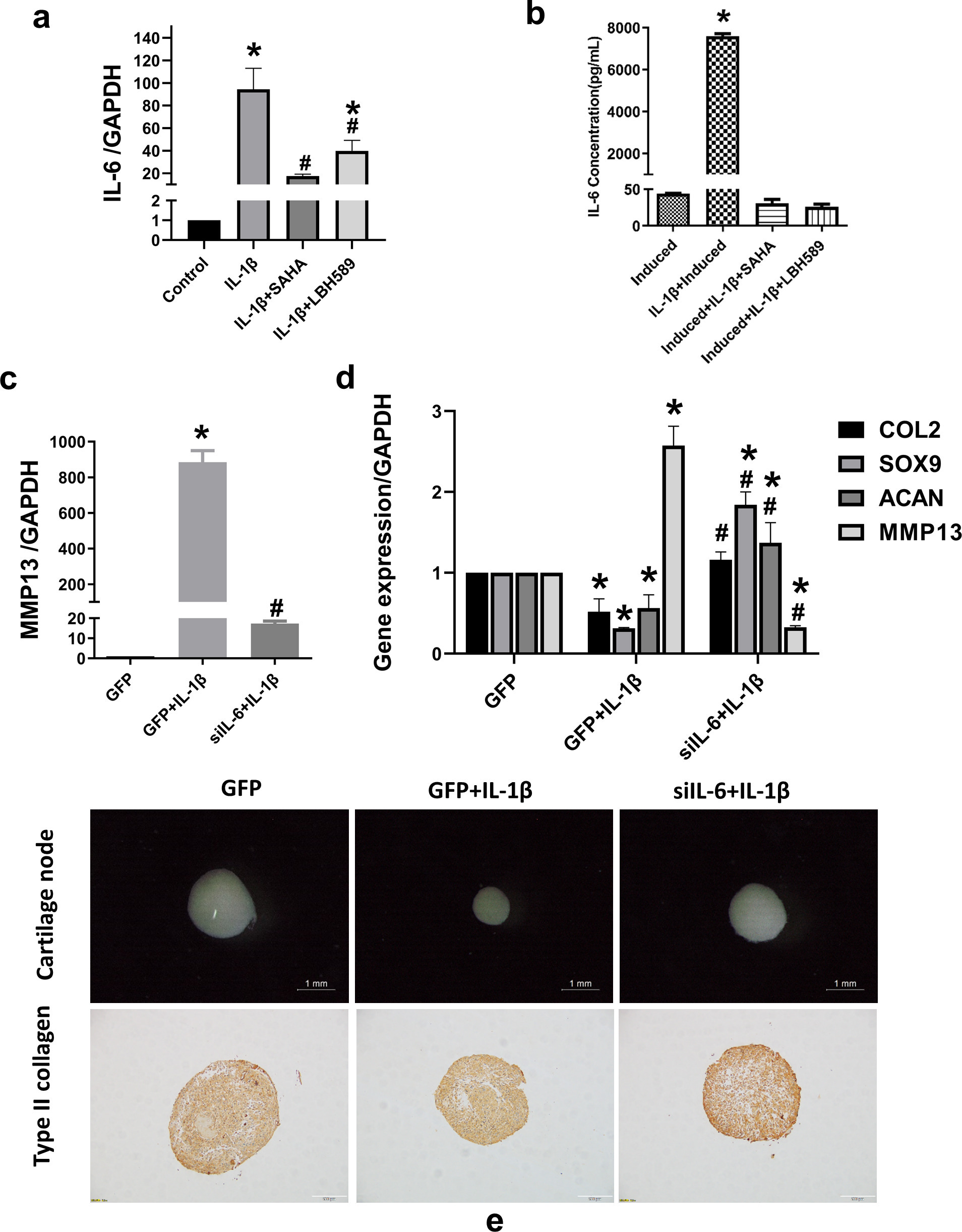 Fig. 4 
            Histone deacetylase (HDAC) inhibitors attenuate interleukin (IL)-6 contributing to the improvement of IL-1β-induced inhibition of chondrogenesis. a) After synovium-derived mesenchymal stem cells (SMSCs) were pre-treated with 10 μM suberoylanilide hydroxamic acid (SAHA) or 3 μM LBH589 for two hours and then treated with 10 ng/ml IL-1β for 24 hours, RNA was extracted. Reverse transcription-quantitative polymerase chain reaction (RT-qPCR) was used to evaluate IL-6 messenger RNA (mRNA) expression; *p < 0.05 compared to the control group. #p < 0.05 compared to the IL-1β-treated group, n = 3. b) Secretion of IL-6 in the supernatant of chondrogenic induction medium, as detected by a cytometric bead array (CBA). c) The expression levels of matrix metalloproteinase 13 (MMP13) were detected after SMSCs were pre-transfected with the empty GFP vector or the knock-down IL-6 GFP vector for 48 hours and then co-treated with 10 ng/ml IL-1β for 24 hours, as detected by RT-qPCR and CBA. d) mRNA expression of type II collagen (COL2), SRY-box transcription factor 9 (SOX9), aggrecan (ACAN), MMP13, and IL-6, as estimated by RT-qPCR after chondrogenic induction; *p < 0.05 compared to the GFP group. #p < 0.05 compared to the GFP+IL-1β group. e) The size of the cartilage pellets, as estimated by stereoscopic microscopy. Scale bar = 1 mm. Immunohistochemical staining of type II collagen in cartilage pellet sections. Scale bar = 100 μm. One-way analysis of variance was used to determine the p-values. Least-Significant Difference (LSD) test was used to analyze data with homogeneous variances, and Games-Howell test was used for data with non-homogeneous variances. GAPDH, glyceraldehyde-3-phosphate dehydrogenase.
          