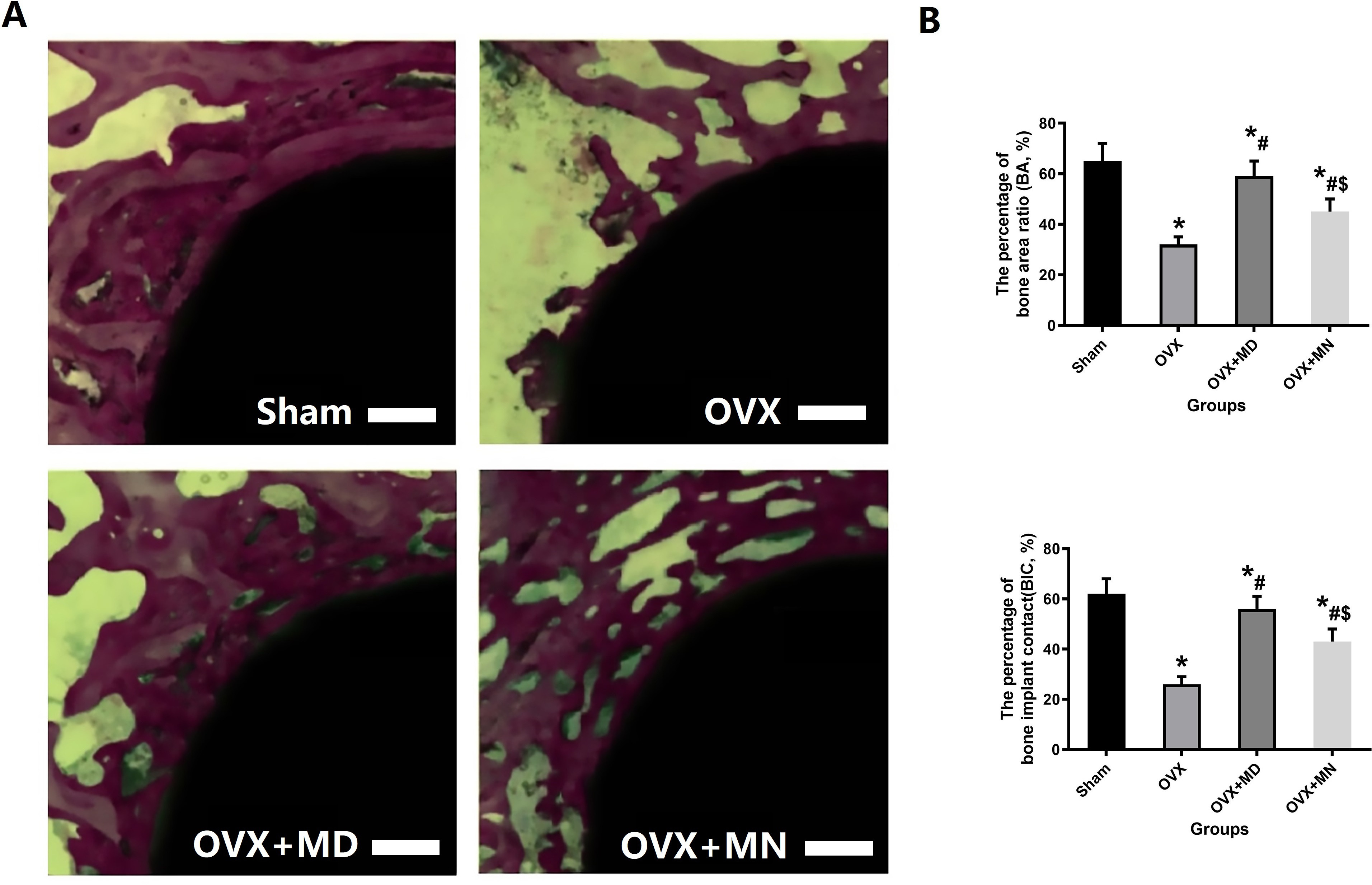 Fig. 2 
            Melatonin treatment can significantly improve bone formation around the titanium rod and increase the connection of bone tissue and internal implants in an ovariectomized (OVX) rat model. a) Bone formation around titanium rods under different intervention conditions, as shown by Von-Gieson staining (×10). b) The percentage of bone implant contact (BIC) and bone area ratio (BA). There were five specimens per group; error bars in the figure indicate the standard deviation. * = vs Sham group, p = 0.018; # = vs OVX, p = 0.005; $ = vs OVX + melatonin day treatment (MD) group, p = 0.005, all independent-samples t-test and one-way analysis of variance. MN, melatonin night treatment.
          