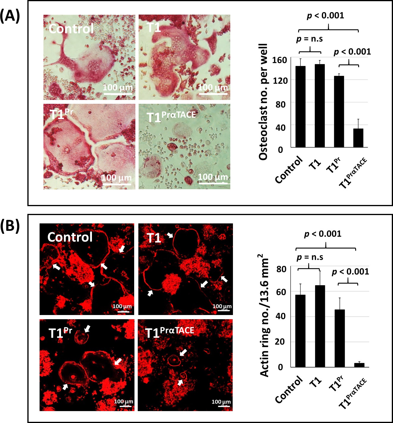 Fig. 2 
            T1PrαTACE abrogated receptor activator of nuclear factor kappa-Β ligand (RANKL)-mediated osteoclast differentiation. a) RAW264.7 cells transduced with T1PrαTACE were not able to transform into osteoclasts in response to RANKL induction. Left: tartrate-resistant acid phosphatase (TRAP)-stained multinucleated osteoclasts 120 hours after induction with RANKL. Right: A significantly lower number of osteoclasts was observed in RAW264.7 cells transduced with T1PrαTACE. b) Phalloidin-stained F-actin rings characteristic of bone-resorbing osteoclasts. In marked contrast to the larger and more irregularly-shaped F-actin rings in the wild-type T1 and T1Pr groups, far fewer F-actin rings were detected in T1PrαTACE cells. Osteoclasts are highlighted by arrows. Statistical significance was determined by analysis of variance. n. s., not significant.
          