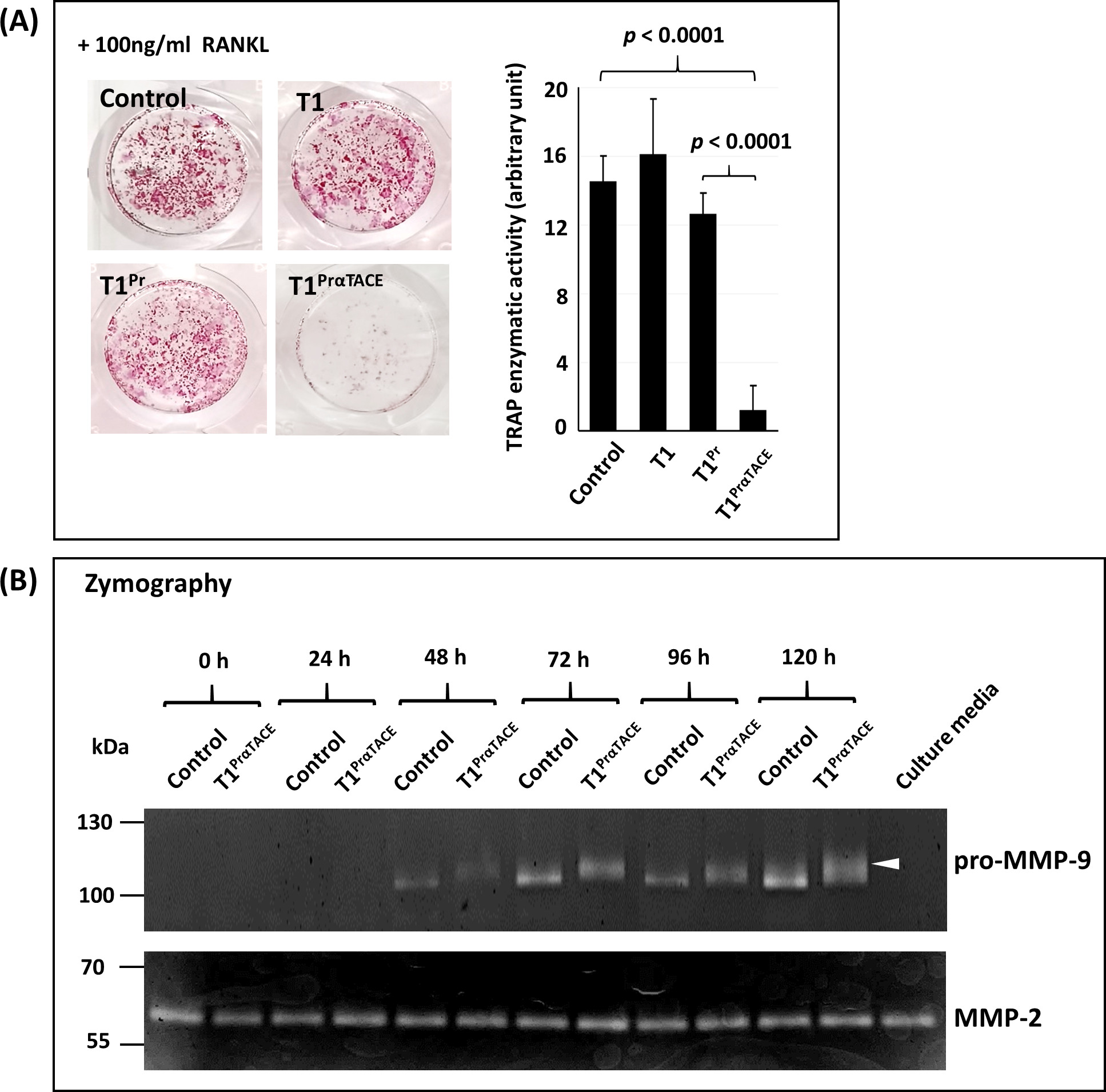Fig. 4 
            T1PrαTACE inhibited tartrate-resistant acid phosphatase (TRAP) expression and matrix metalloproteinase (MMP)-9 maturation in osteoclast progenitor cells. a) RAW264.7 progenitor cells transduced with T1PrαTACE exhibited a > 90% lower TRAP staining (left) and activity (right) than the other tissue inhibitor of metalloproteinases (TIMP) variants. b) Gelatin zymography analysis of the conditioned media revealed that MMP-9 expressed in T1PrαTACE cells existed mainly in a zymogen form (102 kDa; highlighted by arrowhead), which migrated at a slower pace than matured MMP-9 (92 kDa). Note: the MMP-2 band in the culture media (last lane) originated from fetal bovine serum added to α-minimum essential medium (5%). RANKL, receptor activator of nuclear factor kappa-Β ligand. Statistical significance was determined by analysis of variance.
          