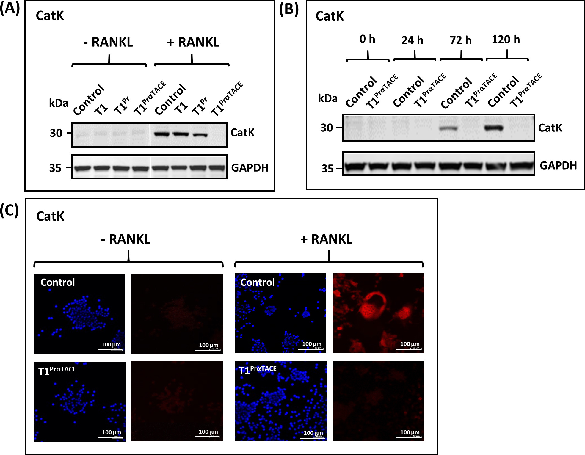 Fig. 5 
            Complete abrogation of cathepsin K (CatK) expression by T1PrαTACE. a) CatK was not detectable in T1PrαTACE as shown by immunoblotting of the cell lysates 120 hours after induction with receptor activator of nuclear factor kappa-Β ligand (RANKL). b) Time course analysis over 120 hours revealed the absence of CatK in T1PrαTACE cells. c) Immunofluorescence (IF) staining shows the absence of CatK in RANKL-induced T1PrαTACE cells (blue: 4′,6-diamidino-2-phenylindole staining of the nucleus; red: IF staining of CatK; ×200 magnification). GAPDH, glyceraldehyde 3-phosphate dehydrogenase.
          