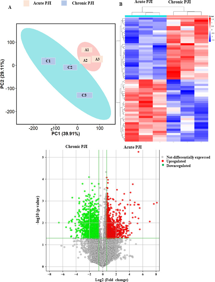 Fig. 4 
            a) Principal component analysis (PCA), b) heat map, and c) volcano map of differentially expressed genes between acute and chronic periprosthetic joint infection (PJI).
          