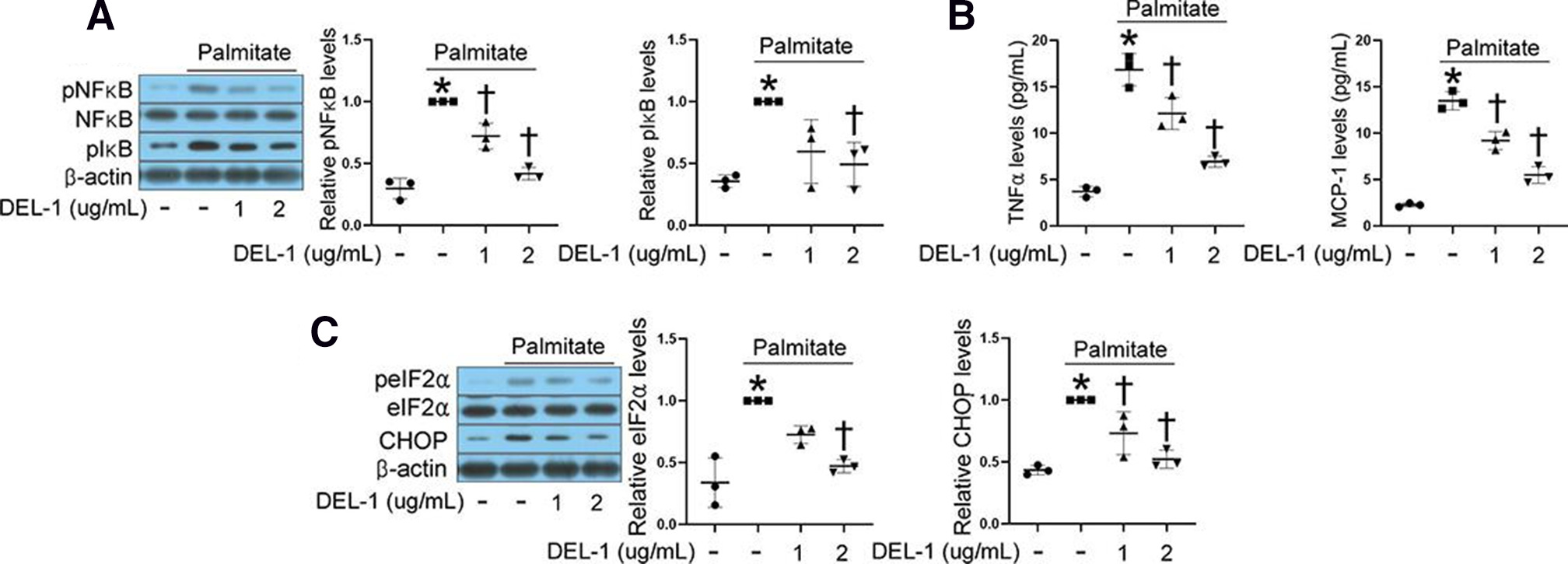 Fig. 2 
            Developmental endothelial locus-1 (DEL-1) suppresses inflammation and endoplasmic reticulum (ER) stress in tenocytes treated with palmitate. a) Western blotting of NFκB and IκB phosphorylation in tenocytes treated with palmitate (400 μM) and DEL-1 (0 to 2 μg/ml) for 24 hours. b) Enzyme-linked immunosorbent assay for determining tumour necrosis factor alpha (TNFα) and monocyte chemoattractant protein-1 (MCP-1) concentrations in the culture medium of tenocytes treated with palmitate (400 μM) and/or DEL-1 (0 to 2 μg/ml) for 24 hours. c) Western blotting of eIF2α phosphorylation and CHOP expression in tenocytes treated with palmitate (400 μM) and/or DEL-1 (0 to 2 μg/ml) for 24 hours. Means and standard deviations were calculated from three independent experiments. Significance (p < 0.05). *: vs control. †: vs palmitate.
          