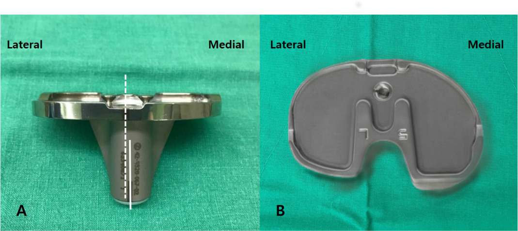 Fig. 1 
          a) Medialized stem of anatomical tibial component (ATC). b) Asymmetric baseplate of ATC.
        