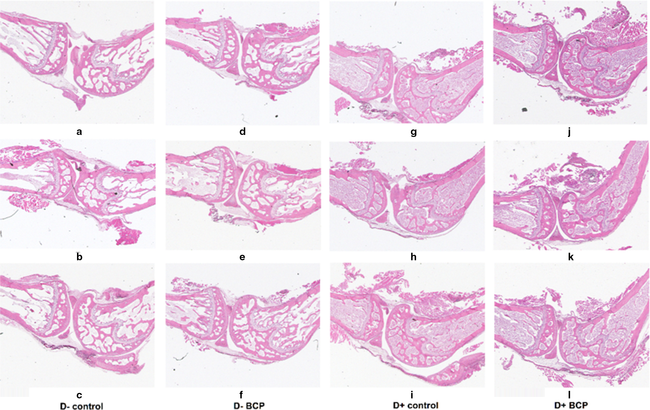 Fig. 4 
            Histopathological features of knee joint tissues in mice from different groups at the endpoint of the experiment. a) to c) Vitamin D-deficient diet (D-) control group. d) to f) D- ß-caryophyllene (BCP) group. g) to i) Standard vitamin D-sufficient diet (D+) control group. j) to l) D+ BCP group.
          