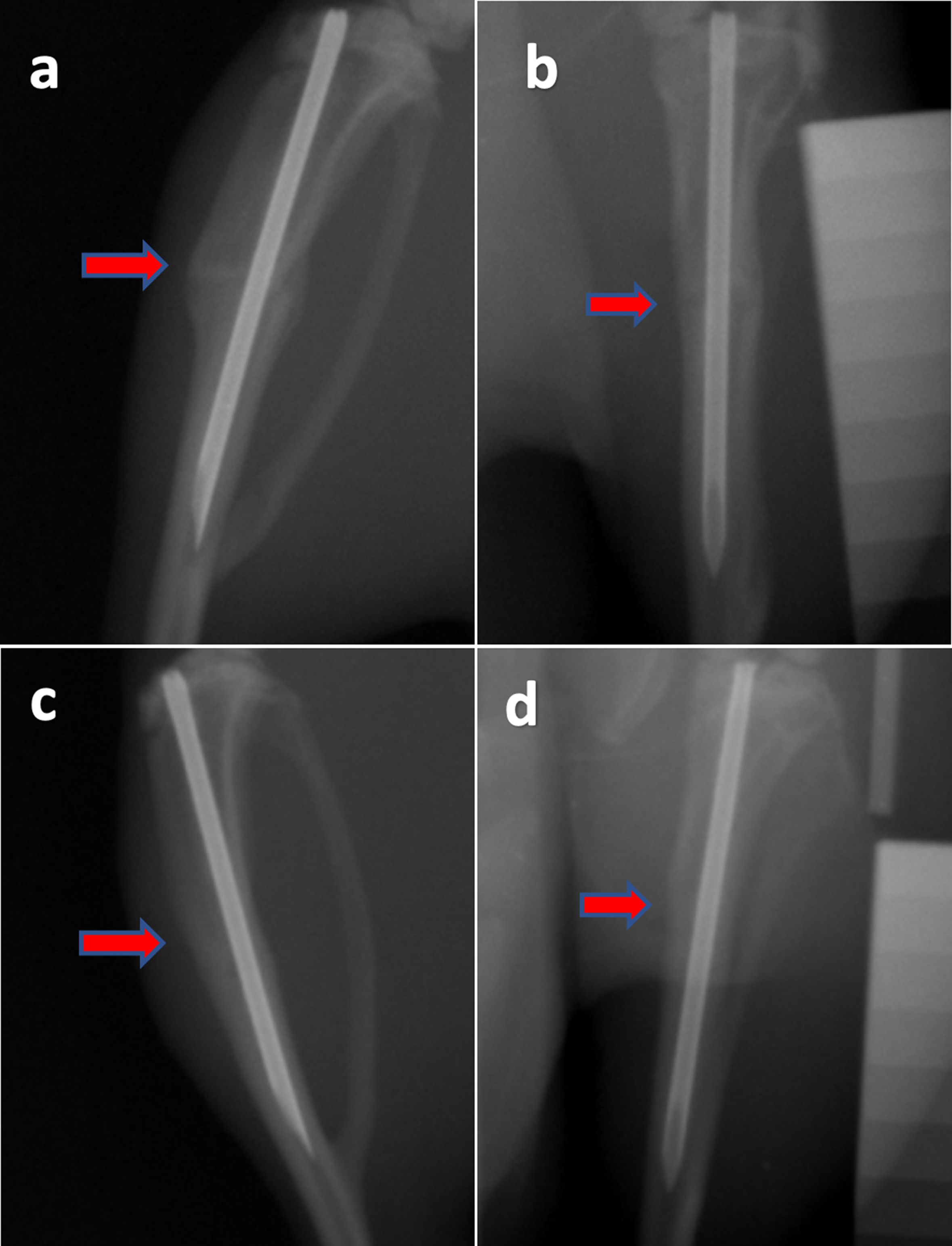 Fig. 2 
            Lateral and anteroposterior radiographs showing a) and b) united tibias in Group 1, and c) and d) united tibias in Group 2 (red arrows), eight weeks postoperatively.
          