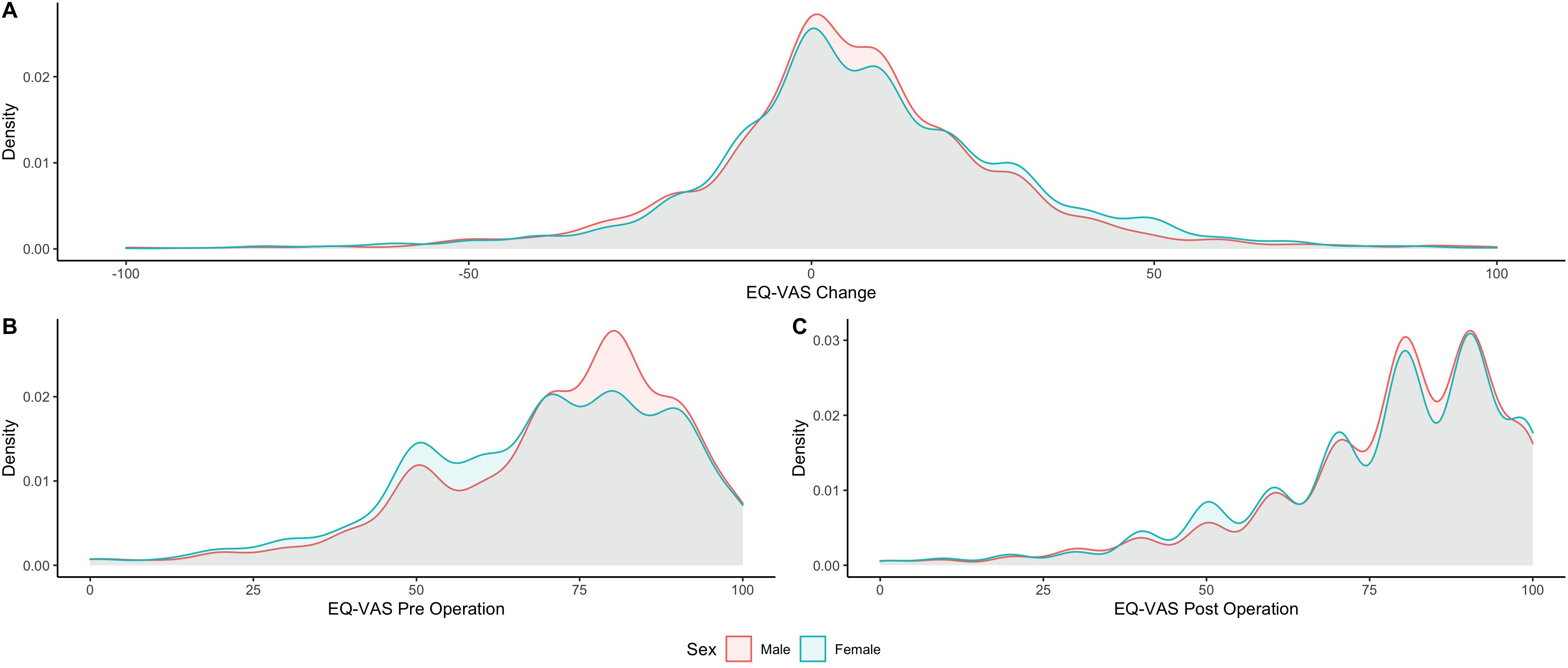 Fig. 2 
            Density plot (distribution) of EuroQol visual analogue scale (EQ-VAS) scores: a) change; b) preoperatively; c) postoperatively.
          