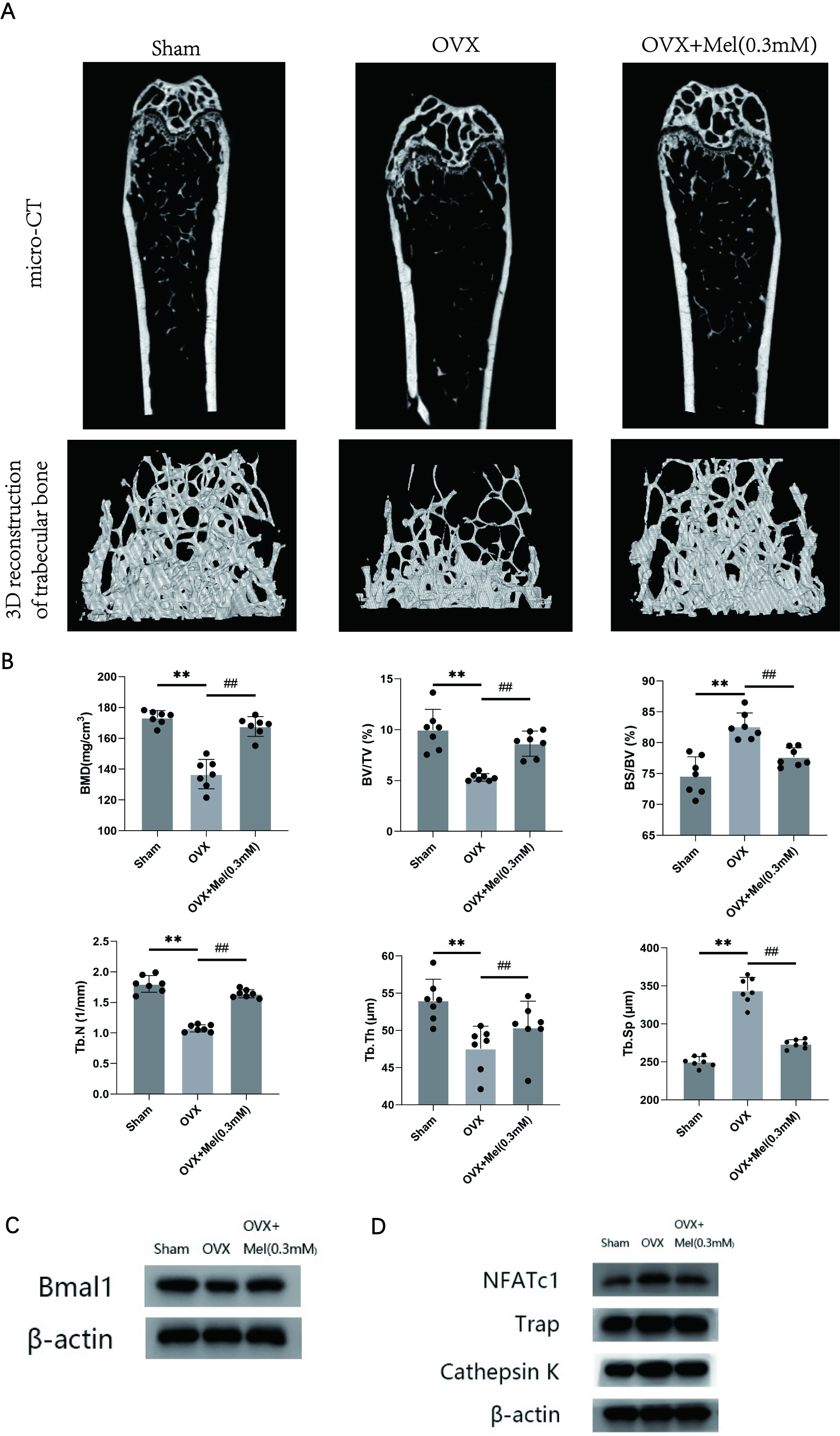 Fig. 5 
            Melatonin (Mel) improves bone loss in ovariectomized (OVX) mice. a) 2D and 3D reconstruction of the femur micro-CT images. b) Related parameters obtained from image analysis. c) Protein levels of the BMAL1 gene and β-actin in femur samples. d) Protein levels of the osteoclast markers in femur samples. Data are means and standard deviations, *p < 0.05, **p < 0.01 compared with sham and #p < 0.05, ##p < 0.01 compared with OVX, analyzed using one-way analysis of variance.
          