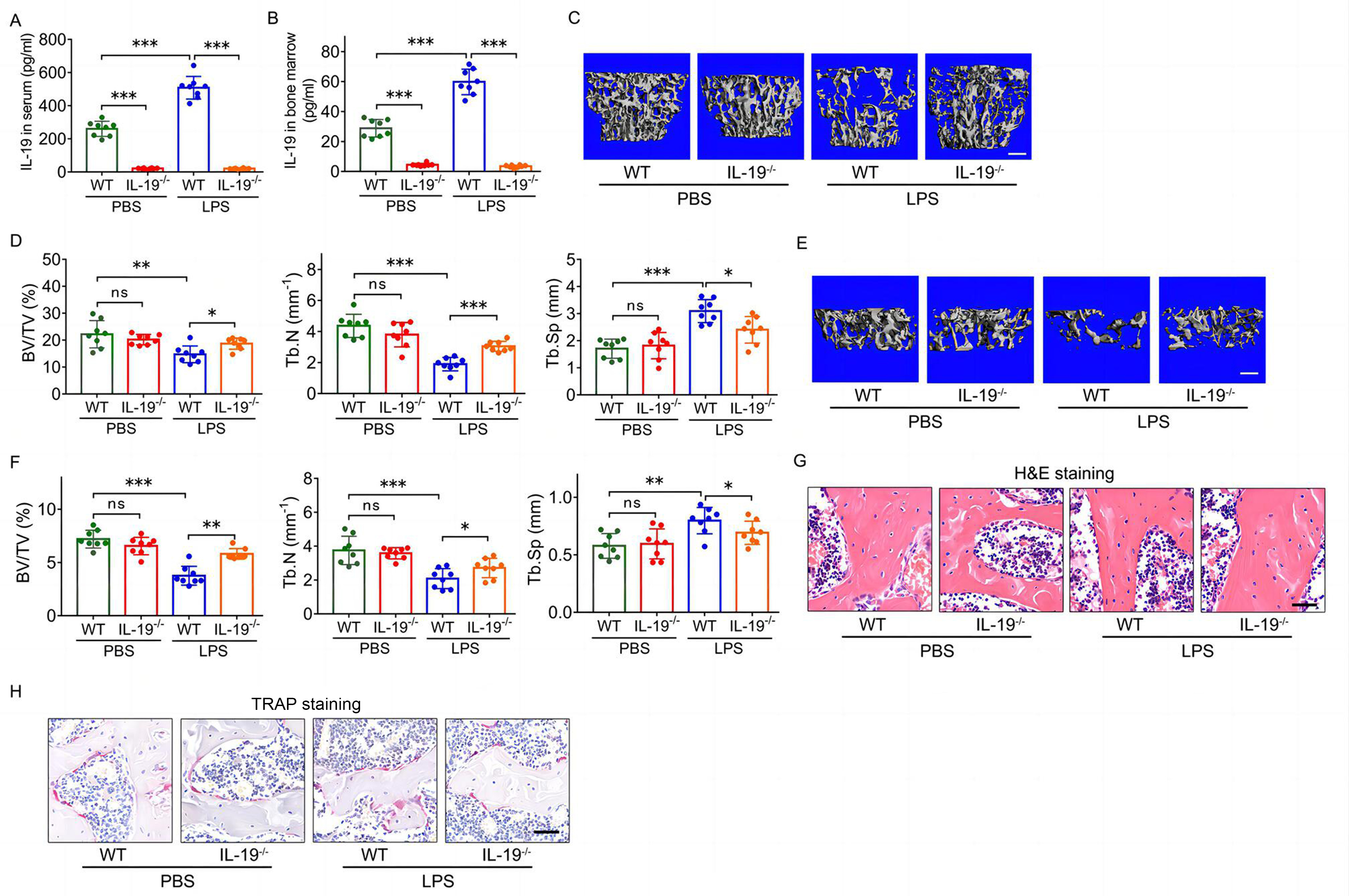 Fig. 3 
            Global deletion of interleukin (IL)-19 counteracts lipopolysaccharide (LPS)-induced trabecular bone loss and bone resorption improvement in mice. a) and b) IL-19 levels in a) peripheral blood serum and b) bone marrow aspirates in LPS-induced bone loss of IL-19-/- mice, determined by enzyme-linked immunosorbent assay (ELISA) (n = 8). c) Representative 3D reconstruction images of lumbar (L) #1 vertebrae trabecular bone in LPS-induced bone loss of IL-19-/- mice, determined by micro-CT. Scale bar: 400 μm. d) Bone volume fraction (BV/TV), trabecular number (Tb.N), and trabecular separation (Tb.Sp) of L1 vertebrae in LPS-induced bone loss of mice (n = 8). e) Representative 3D reconstruction images of distal femur trabecular bone in LPS-induced bone loss of IL-19-/- mice, determined by micro-CT. Scale bar = 400 μm. f) BV/TV, Tb.N, and Tb.Sp of distal femur in LPS-induced bone loss of IL-19-/- mice (n = 8). g) Haematoxylin and eosin (H&E) staining of femur trabecular bone in LPS-induced bone loss of mice (n = 8). Scale bar: 40 μm. h) Tartrate-resistant acid phosphatase (TRAP) staining of femur bone in LPS-induced bone loss of mice (n = 8). Scale bar: 40 μm. Data are representative of three independent experiments, and shown as means and standard deviations. P-values were determined by one-way analysis of variance (ANOVA) followed by Tukey’s test (a, b, d, f). *p < 0.05, **p < 0.01, ***p < 0.001. ns, no significance; PBS, phosphate-buffered saline; WT, wild-type.
          