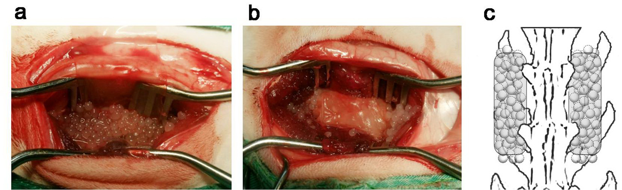 Fig. 2 
            Photographs demonstrating the appearance of the bone graft materials, and schematic of the exact anatomical location of the material implanted. a) Alginate bead materials without collagen/chitosan cell sheet wrapping. b) Alginate bead materials wrapped with collagen/chitosan cell sheet to fabricate a bone-periosteum composite implanted between L4 and L5 transverse space. c) Exact anatomical location of the material implanted in bilateral L4-L5 inter-transverse spaces.
          