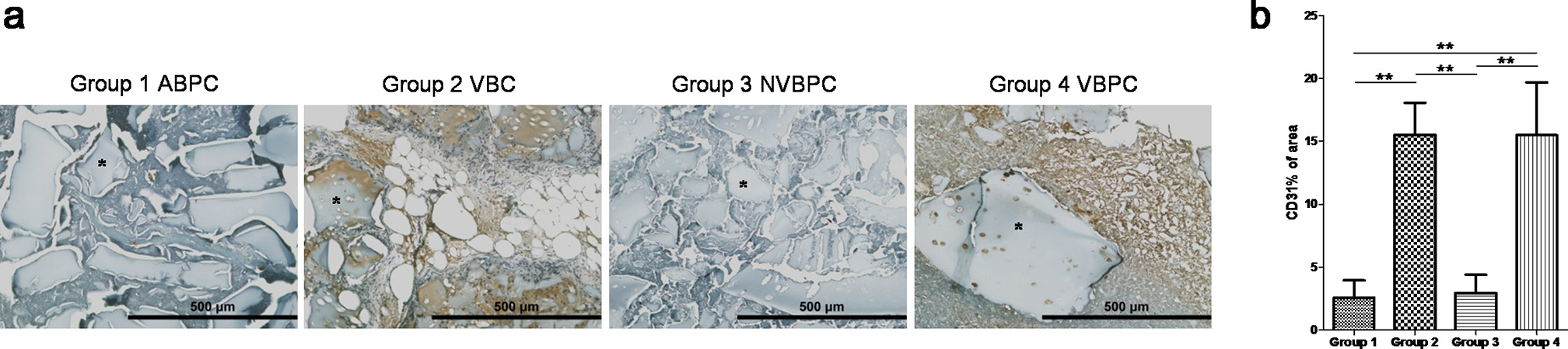 Fig. 7 
            Immunohistochemistry stain of CD31+ blood vessel formation after 12-week implantation in vivo. a) Better performance of CD31+ blood vessel formation (indicated by *) appeared for Group 2 and Group 4. b) Semiquantitative analysis confirmed the image results. **p < 0.001. ABPC; NVBPC, non-vascularized bone-periosteum construct; VBC, vascularized bone construct; VBPC, vascularized bone-periosteum construct.
          