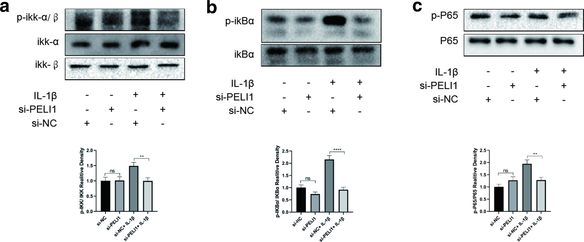 Fig. 3 
            Knockdown of Pellino1 (Peli1) inhibits nuclear factor kappa B (NF-κB) signalling in chondrocytes. a) Western blot showing that Peli1 knockout affected NF-κB signaling-related protein p-IKK/IKK. b) Western blot showing that Peli1 knockout affected NF-κB signaling-related protein p-IKBα/IKBα. c) Western blot showed that Peli1 knockout affected NF-κB signaling-related protein p-P65/P65. **p < 0.01, ****p < 0.0001 compared with si-NC transfected or si-NC+ IL-1β-treated chondrocytes.
          