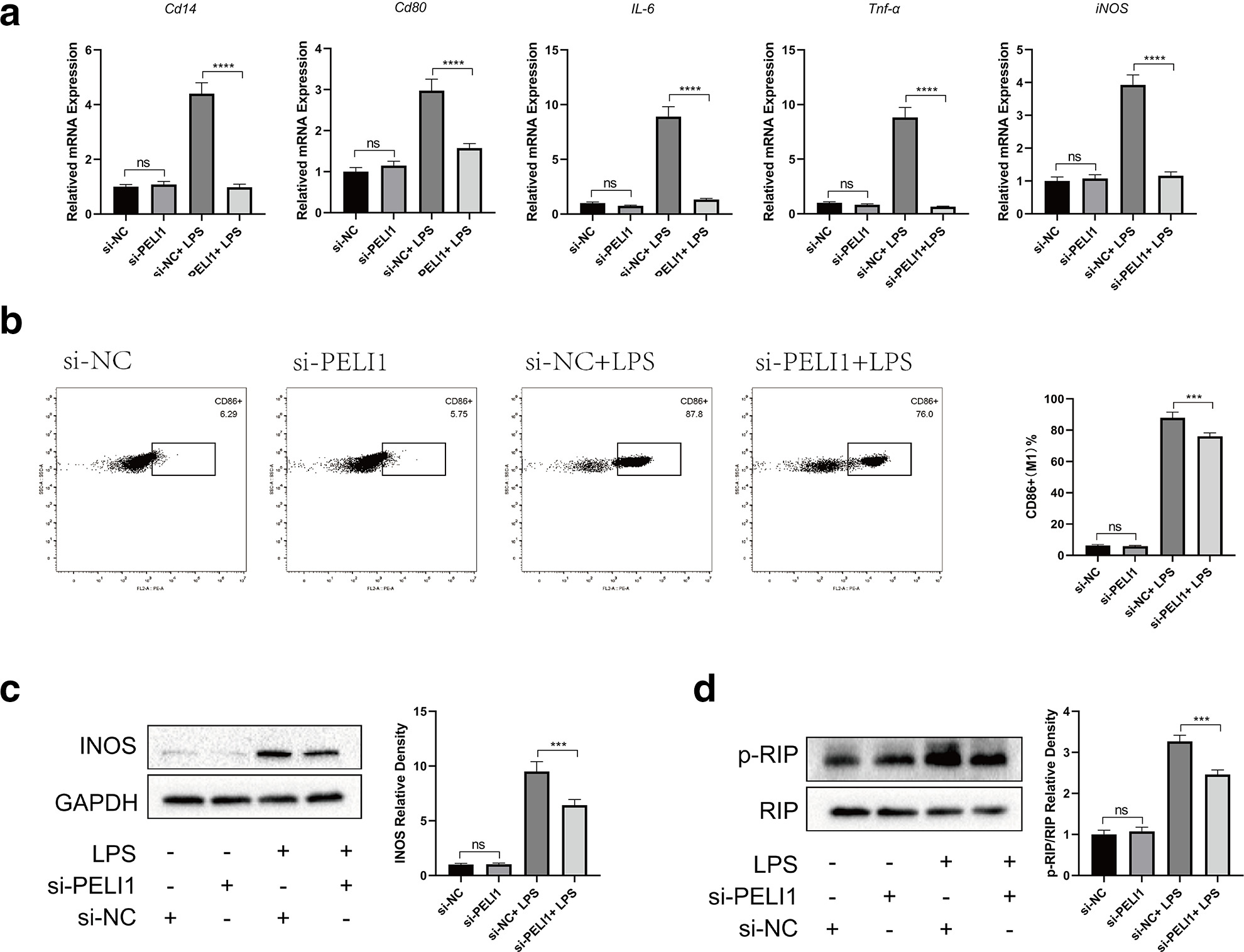 Fig. 4 
            Knockdown of Pellino1 (Peli1) inhibits M1 polarization of macrophages. a) Expression of macrophage M1-related genes Cd14, Cd80, IL-6, TNF-α, and inducible nitric oxide synthase (iNOS) was evaluated by reverse transcription quantitative polymerase chain reaction (RT-qPCR). b) Flow cytometry was used to evaluate macrophage M1-polarization by staining CD86. c) The expression of iNOS was evaluated by western blot. d) Evaluation of p-RIP/RIP expression by western blotting. ***p < 0.001, ****p < 0.0001 compared with si-NC transfected or si-NC+ LPS-treated RAW264.7 cells. GAPDH, glyceraldehyde 3-phosphate dehydrogenase; LPS, lipopolysaccharide; mRNA, messenger RNA; NS, not significant.
          