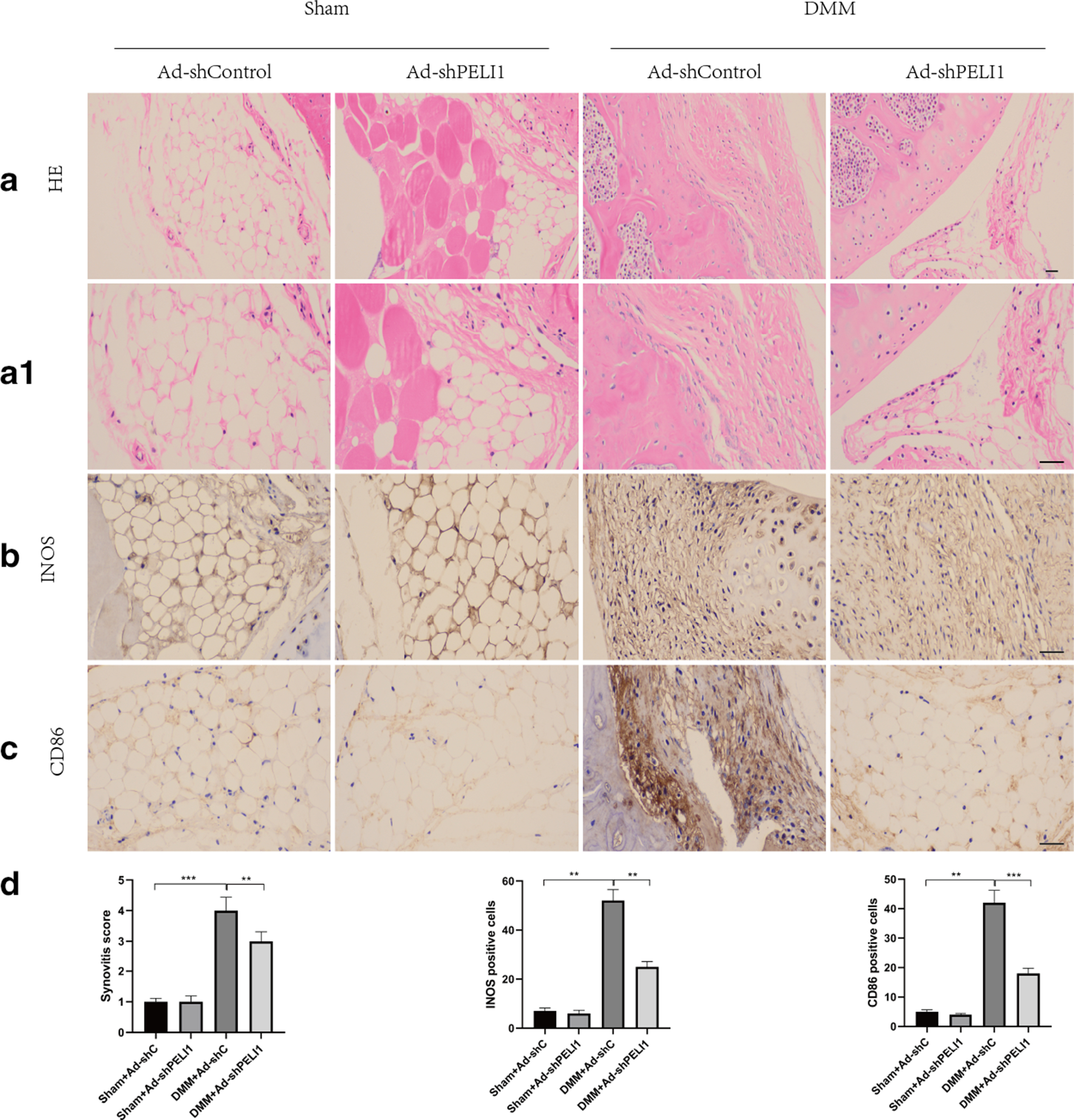 Fig. 7 
            Knockout of Pellino1 (Peli1) can reduce synovial inflammation in the destabilized medial meniscus (DMM) model. a) and a1) Haematoxylin and eosin (H&E) staining of synovium from AD-SH Control and AD-SH Peli1 mice two months after DMM surgery. b) Inducible nitric oxide synthase (iNOS) immunostaining images of synovium from AD-SH Control and AD-SH Peli1 mice two months after DMM surgery. c) CD86 immunostaining images of synovium from AD-SH Control and AD-SH Peli1 mice two months after DMM surgery. d) Quantitative analysis of synovitis score and iNOS and CD86 expression. **p < 0.01, ***p < 0.001 compared with Sham + AD SH Control or DMM + AD SH Control group. measuring scale = 100 μm.
          