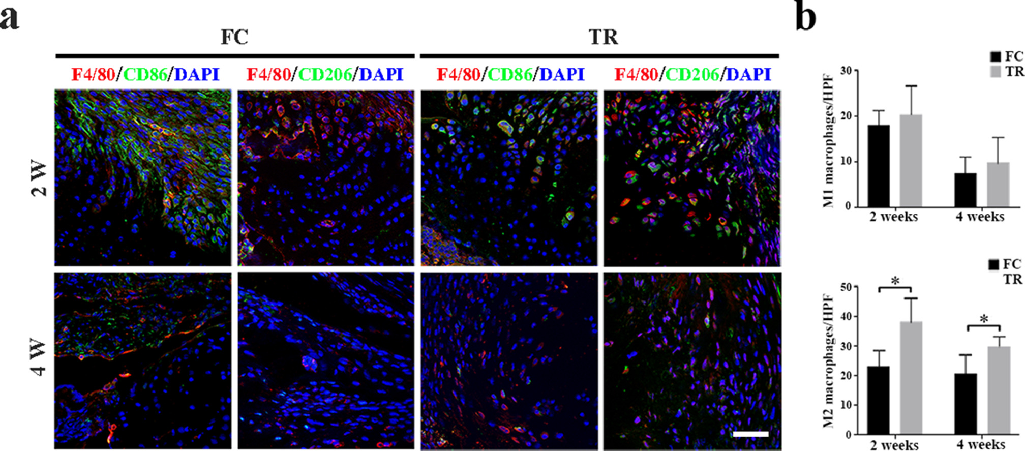 Fig. 1 
            The effects of mechanical stimulation on macrophage polarization during rotator cuff (RC) tendon-bone (T-B) healing. a) Immunofluorescent staining of total macrophages biomarker, F4/80 (red), and M1-like macrophage biomarker, CD86 (green) or M2-like macrophage biomarker, CD206 (green) in the repaired RC tendon-bone interface (TBI) at two and four weeks after surgery. Scale bar: 100 µm. b) Quantification of M1 (F4/80+CD86+ cells) and M2 macrophages (F4/80+CD206+ cells) in Fig. 1a. N = 6 per group. *p < 0.05, two-way analysis of variance followed by Tukey’s multiple comparisons test. DAPI, 4’,6-diamidino-2-phenylindole; FC, free cage activities group; HPF, high-power field; TR, treadmill running group.
          