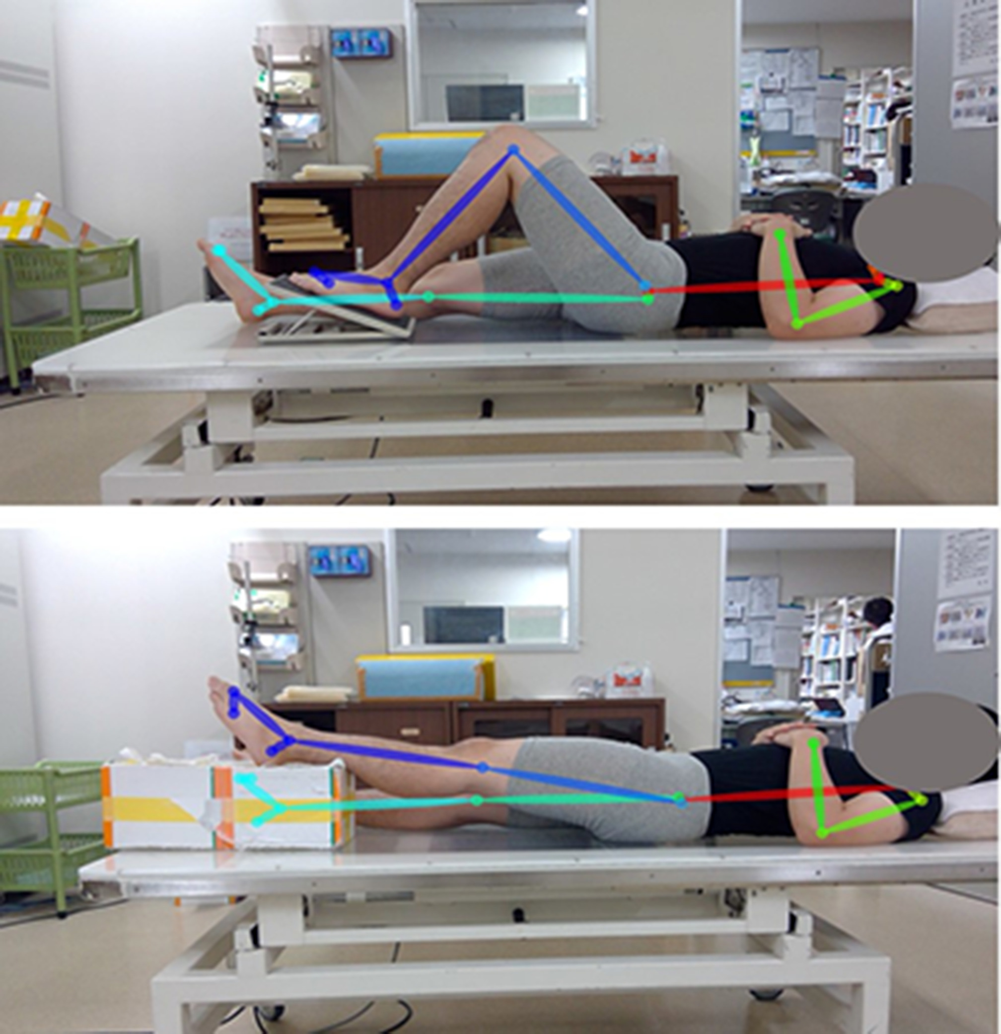 Fig. 2 
            Image after pose estimation by OpenPose. Above: flexion position. Below: extension position.
          