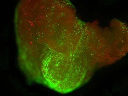 Figs. 3a - 3c 
            Figures 3a and 3b – fluorescent
photomicrographs of tendon explants using Live/Dead staining, in
a) control tissue, showing a high proportion of live tenocytes (in
green) with few dead cells (in red) present, and b) in tissue exposed
to the gentian violet ink marker, showing the majority of present
cells as being dead (in red). Figure 3c – histogram comparing mean
cell viability between control and inked implants, showing significantly
less live cells in inked implants compared with the controls (** p = 0.0055).
The error bars show the standard error of the mean.
          