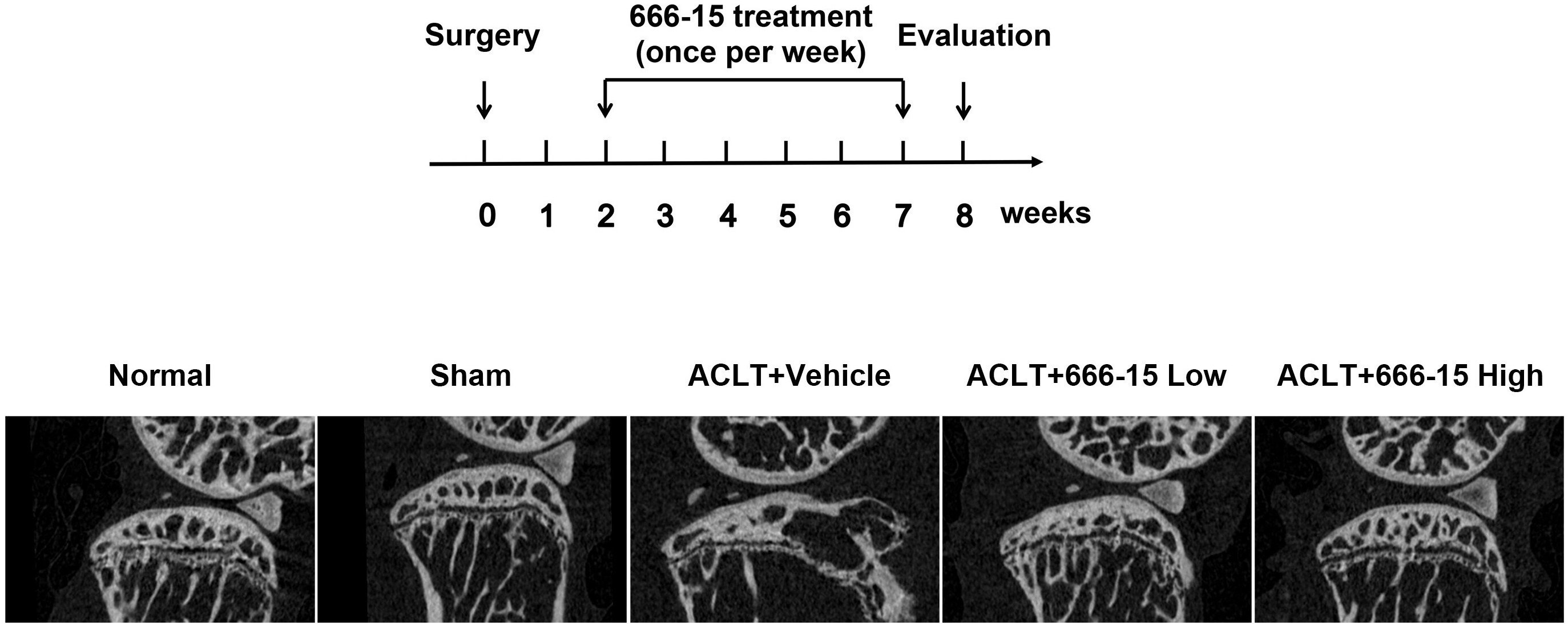 Fig. 7 
            666-15 improved deteriorated subchondral bone in an osteoarthritis mouse model with anterior cruciate ligament transection (ACLT). a) Schematic of the in vivo study design employed to investigate the effects of 666-15 on joint degeneration in ACLT mice. b) Representative μCT images of the medial part of subchondral bone.
          