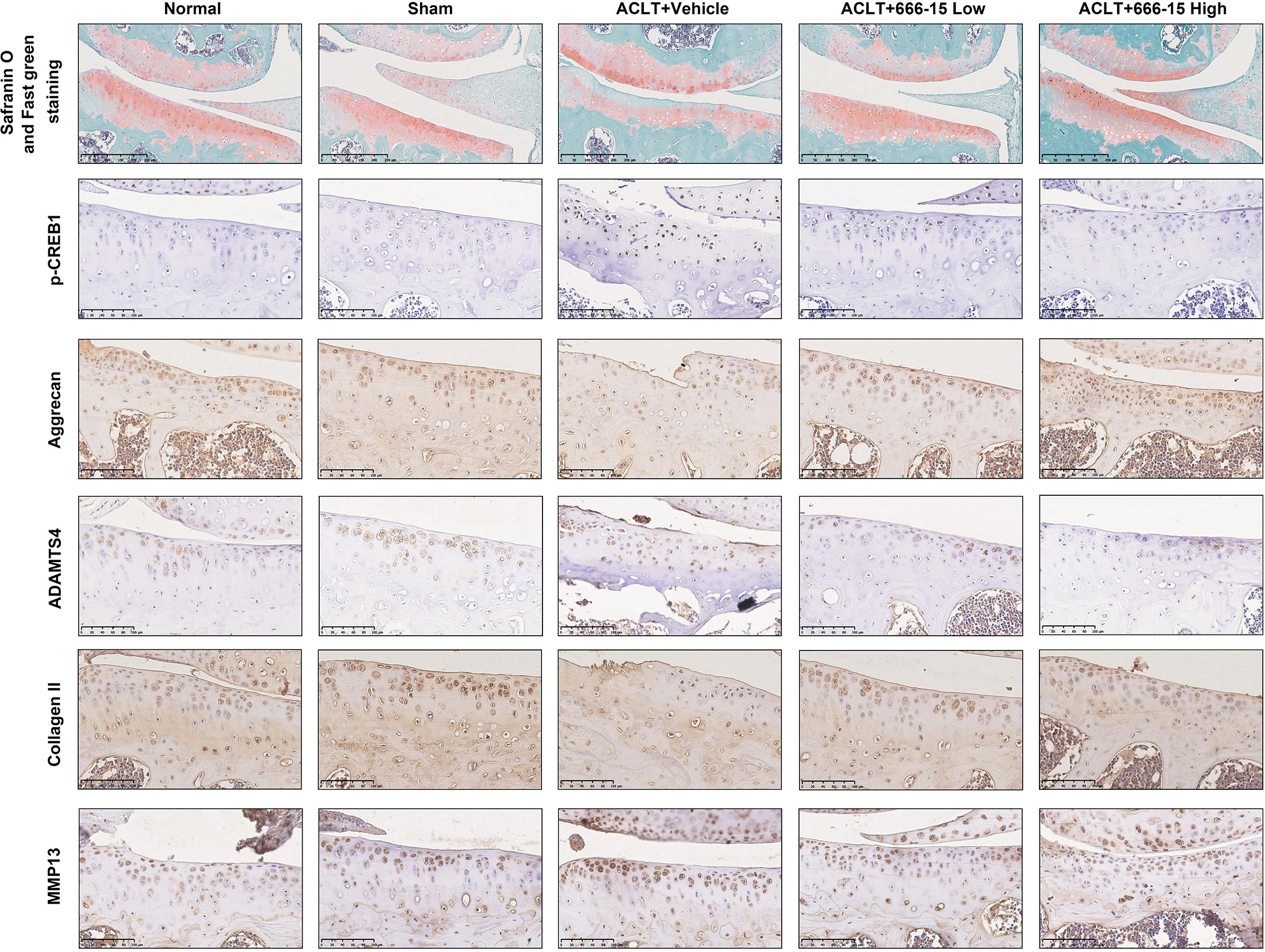 Fig. 9 
            666-15 alleviated anterior cruciate ligament transection (ACLT)-induced articular cartilage degeneration. Representative micrographs of S/F staining of the cartilage of each group (scale bars = 250 μm) and IHC staining of cAMP response element binding protein (p-CREB1), aggrecan, a disintegrin and metalloproteinase with thrombospondin motifs 4 (ADAMTS4), collagen II, and matrix metalloproteinase 13 (MMP13) in the cartilage of each group (scale bars = 100 μm).
          