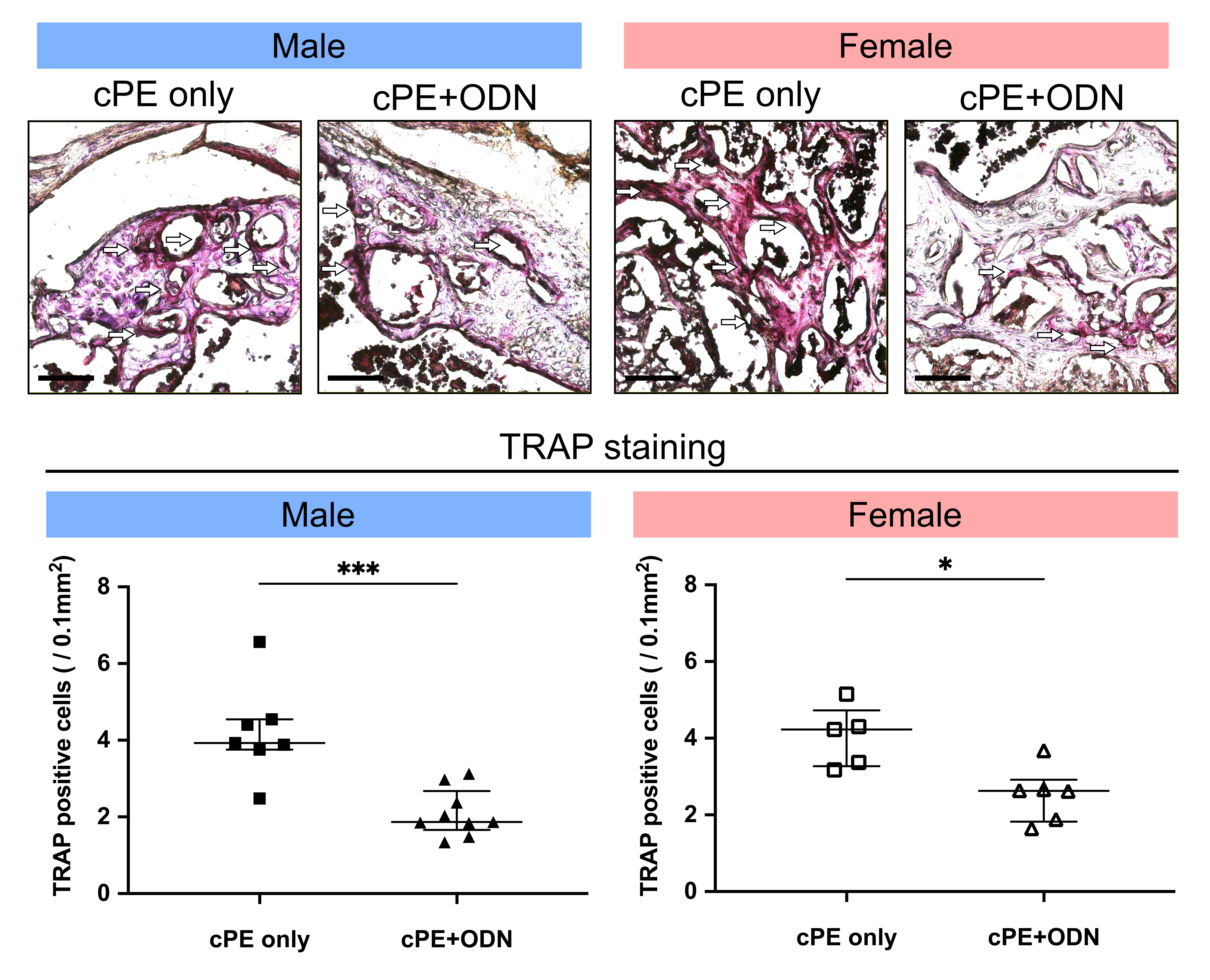 Fig. 3 
            Tartrate-resistant acid phosphatase (TRAP) staining in vivo. Representative images of TRAP staining and quantitative analysis of TRAP-positive cells (white arrows) are shown (scale bar = 100 μm) for male (control group: n = 7; oligodeoxynucleotide (ODN) group: n = 9) and female mice (control group: n = 5; ODN group: n = 6). *p < 0.05, ***p < 0.001, Mann-Whitney U test. cPE, contaminated polyethylene particles.
          