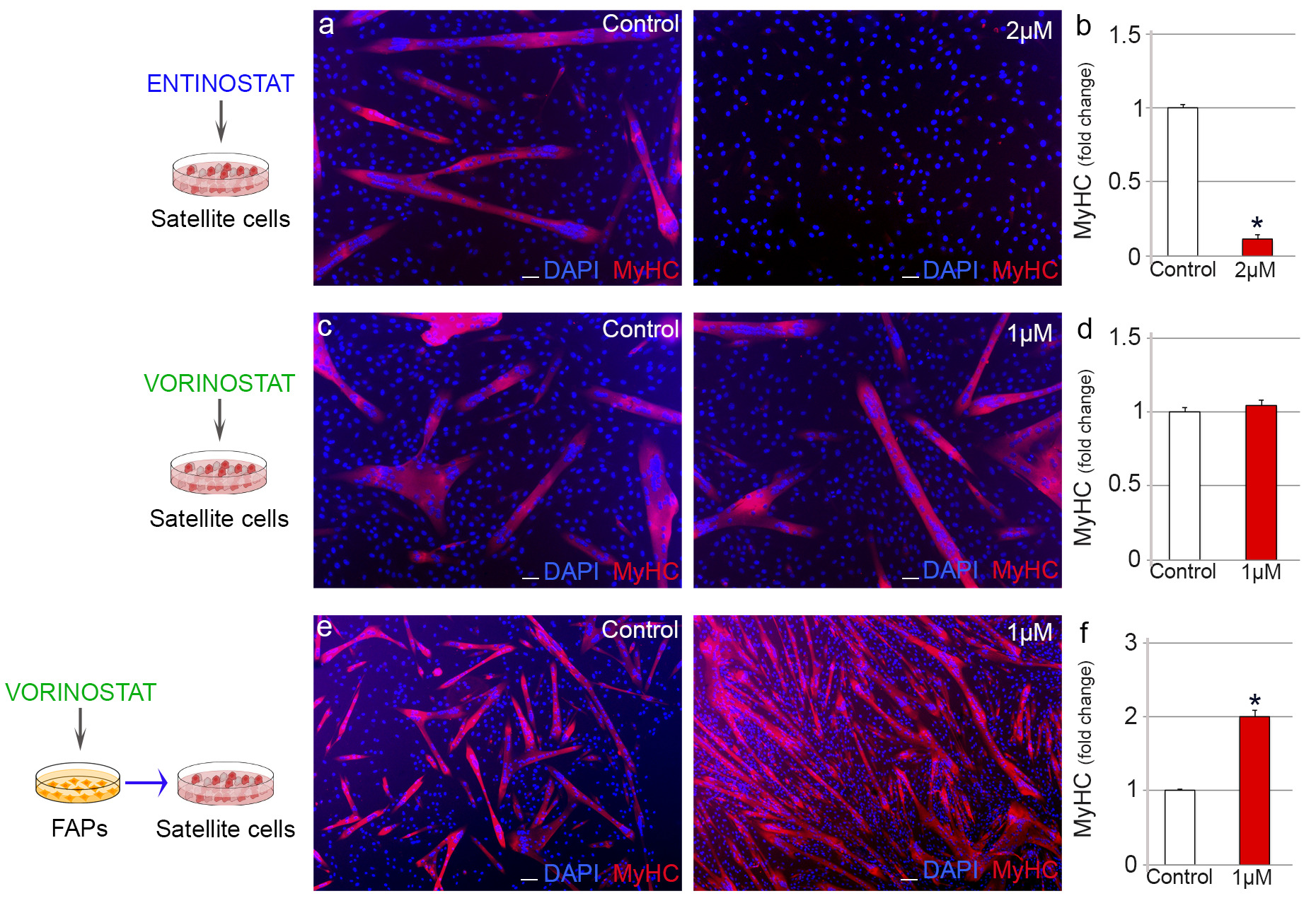 Fig. 2 
            Vorinostat modifies the myogenic potential of satellite cells through its effect on fibro-adipogenic progenitors (FAPs). a), c), and e) Representative images of satellite cells immunostained for myosin (MyHC), and b), d), and f) quantification of the myogenic differentiation after the a) to d) direct or e) and f) indirect daily administration of histone deacetylase inhibitor (HDACi). 4',6-diamidino-2-phenylindole (DAPI) was used to identify all nuclei. Scale bar, 10 μm. Numerical data in HDACi-treated cells were expressed as a fold change compared to control cells, and expressed as the mean and standard error of the mean of at least three independent experiments. *Significance between experimental groups where p < 0.05.
          