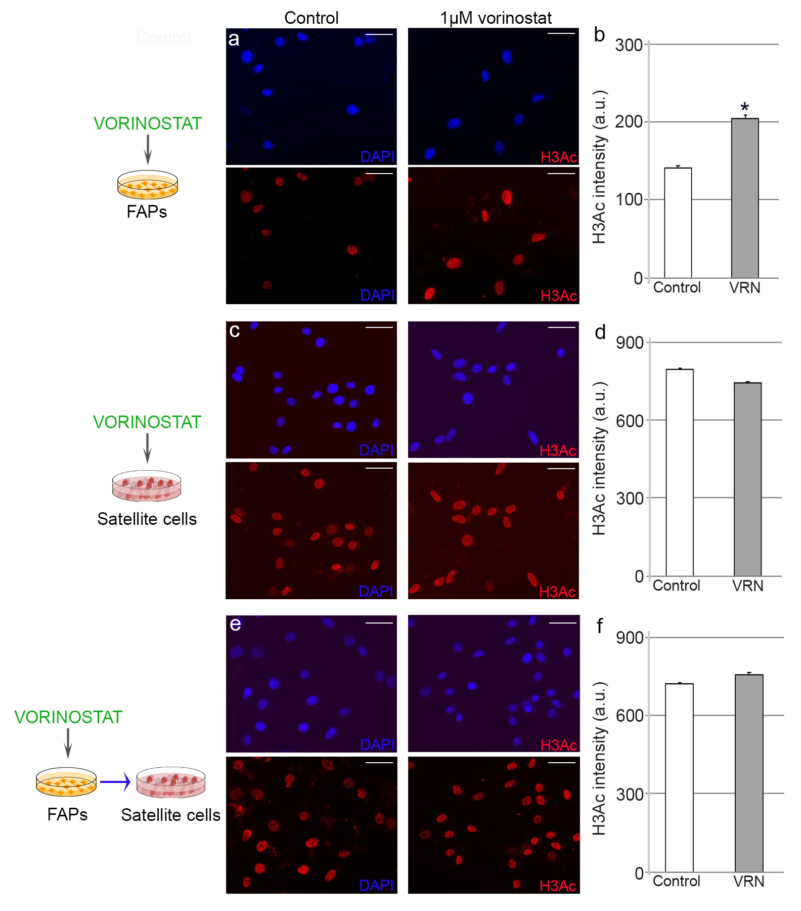 Fig. 3 
            Vorinostat modifies histone acetylation levels in fibro-adipogenic progenitors (FAPs). Representative images of a) FAPs and c) and e) satellite cells from control and vorinostat-treated groups immunostained for histone 3 acetylation (H3Ac) after the a) and c) direct or e) indirect addition of the histone deacetylase inhibitor. Graphs in b), d), and f) show the mean H3Ac intensity accumulated in the cells. 4',6-diamidino-2-phenylindole (DAPI) was used to identify all nuclei. Scale bar, 10 μm. Numerical data were expressed as the mean and standard error of the mean of at least three independent experiments. *Significance between experimental groups where p < 0.05, Shapiro Wilk and Mann-Whitney U tests. a.u., arbitrary units; VRN, vorinostat.
          