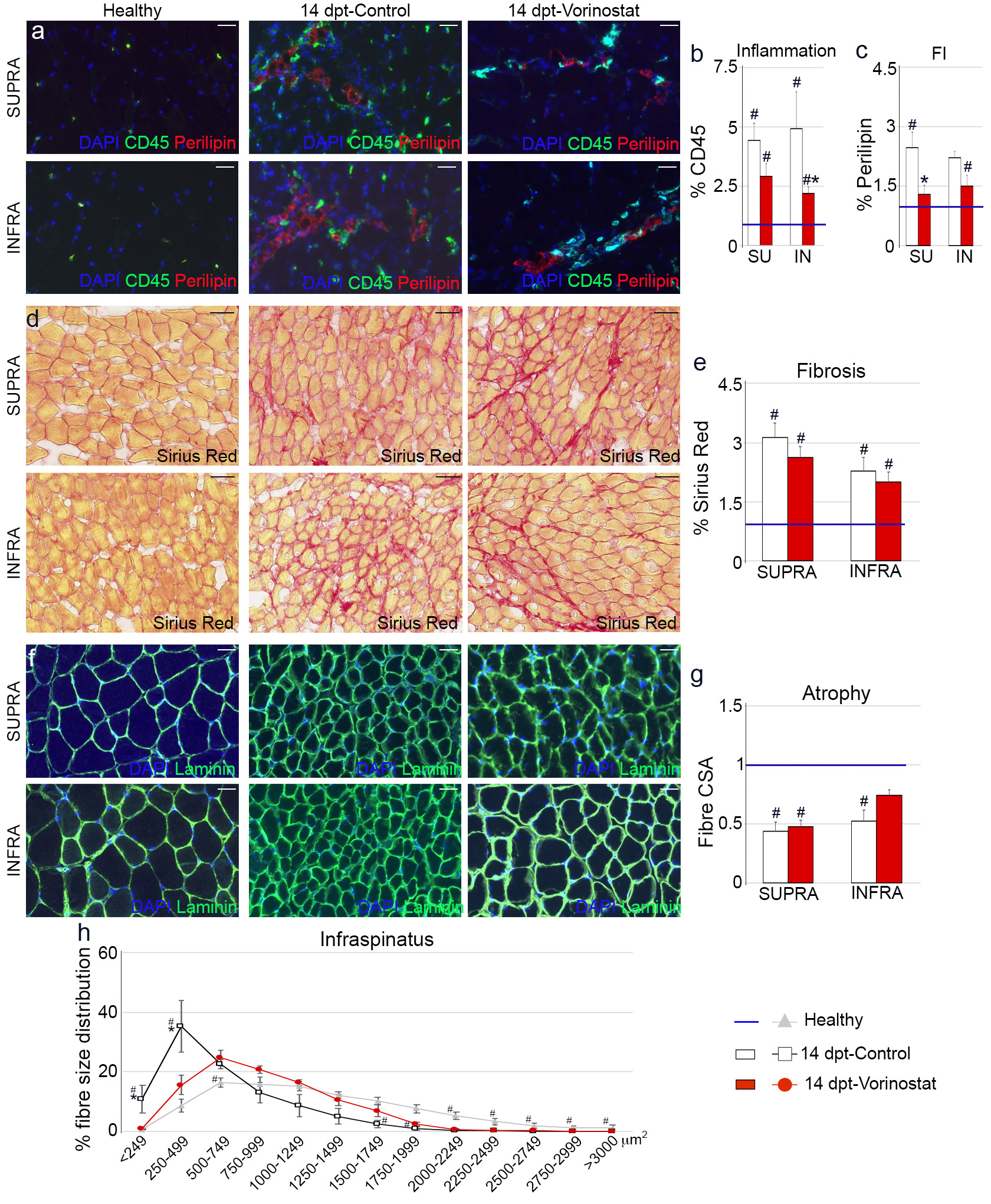Fig. 4 
            Vorinostat reduces muscle degeneration after tenotomy. Representative images of immunostained muscle tissue sections for a) CD45/Perilipin, d) Sirius red, and f) laminin from healthy (n = 6) and injured mice, treated (n = 4) or not treated (n = 4) with vorinostat for 12 days, two days after rotator cuff (RC) injury. 4',6-diamidino-2-phenylindole (DAPI) was used to identify all nuclei. Scale bar, 10 μm. Graphs show the presence of b) cellular, c) fatty, and e) fibrotic accumulation in the muscles. g) Mean cross-sectional area of the supra- and infraspinatus muscles from healthy and vorinostat-treated and untreated injured mice. h) Fibre size distribution of the infraspinatus muscles from the different experimental conditions. Data were expressed as the mean and standard error of the mean, where expression levels were related to those found in healthy muscles, which were considered as 1 (blue line). *Significance between control and vorinostat-treated injured mice. ‘#’ defines significance between healthy and injured mice, where p < 0.05, Shapiro-Wilk test, Mann-Whitney U test, and independent-samples t-test. dpt, days post-tenotomy; FI, fatty infiltration; IN and INFRA, infraspinatus; SU and SUPRA, supraspinatus.
          