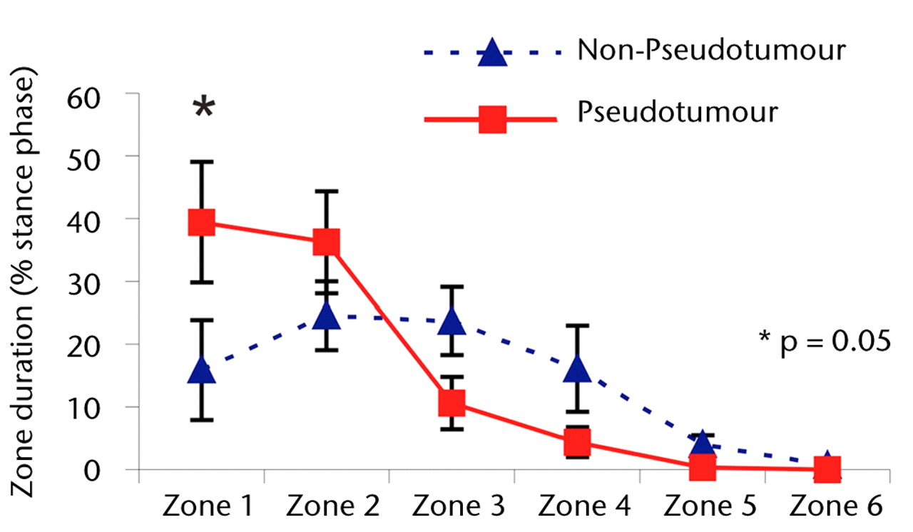 Figs. 3a - 3c 
            Graphs showing the distribution
of ‘zone duration’ (the percentage of total stance time spent by
the force path in each zone) during a) walking, b) stair climbing
and c) rising from a chair. Zone 1 is defined as the edge-loading
zone. The error bars represent standard errors of mean. An asterisk
(*) indicates significant difference between the two MoMHRA patient
groups.
          