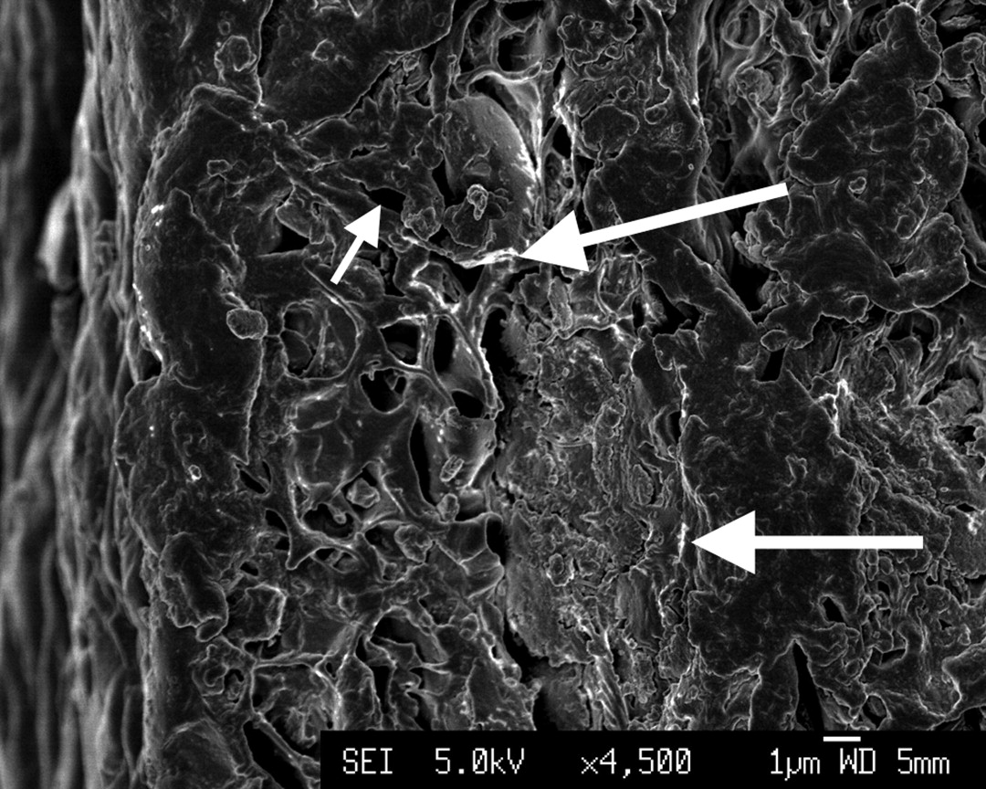 Figs. 2a - 2b 
            Scanning electron microscopy images
of α-tricalcium phosphate/poly(D,L-lactide-co-glycolide) (α-TCP/PLGA)
before hot-pressing at a) × 4500 magnification, showing pores (small
arrow) and α-TCP particles (large arrow), and b) at × 80 000 magnification, showing
an α-TCP particle (circled).
          