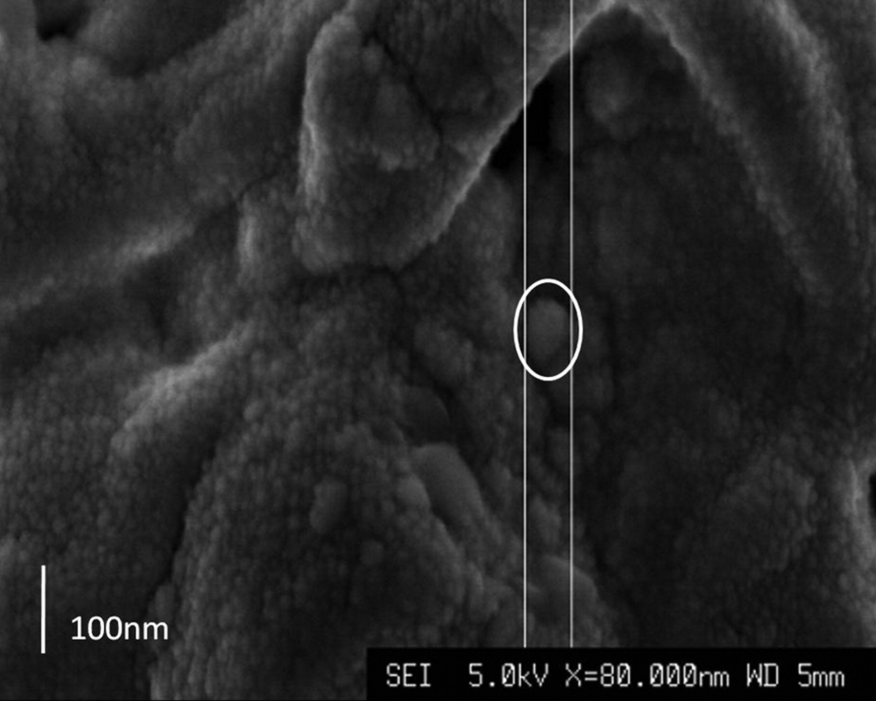 Figs. 2a - 2b 
            Scanning electron microscopy images
of α-tricalcium phosphate/poly(D,L-lactide-co-glycolide) (α-TCP/PLGA)
before hot-pressing at a) × 4500 magnification, showing pores (small
arrow) and α-TCP particles (large arrow), and b) at × 80 000 magnification, showing
an α-TCP particle (circled).
          