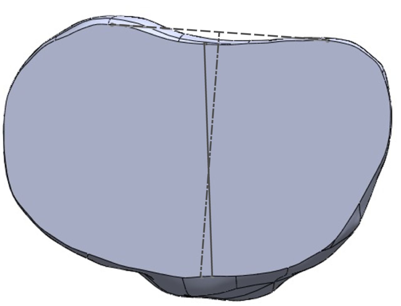 Fig. 2 
            Diagram showing the anterior tibial
tubercle axis (ATT; solid grey line) and the posterior condylar
axis (PCA; dashed line).
          